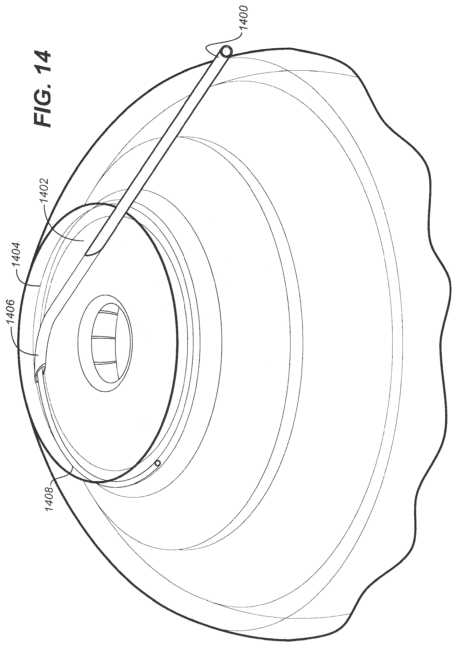 Patent US12350192 Figure 16 – Ocular delivery systems and methods