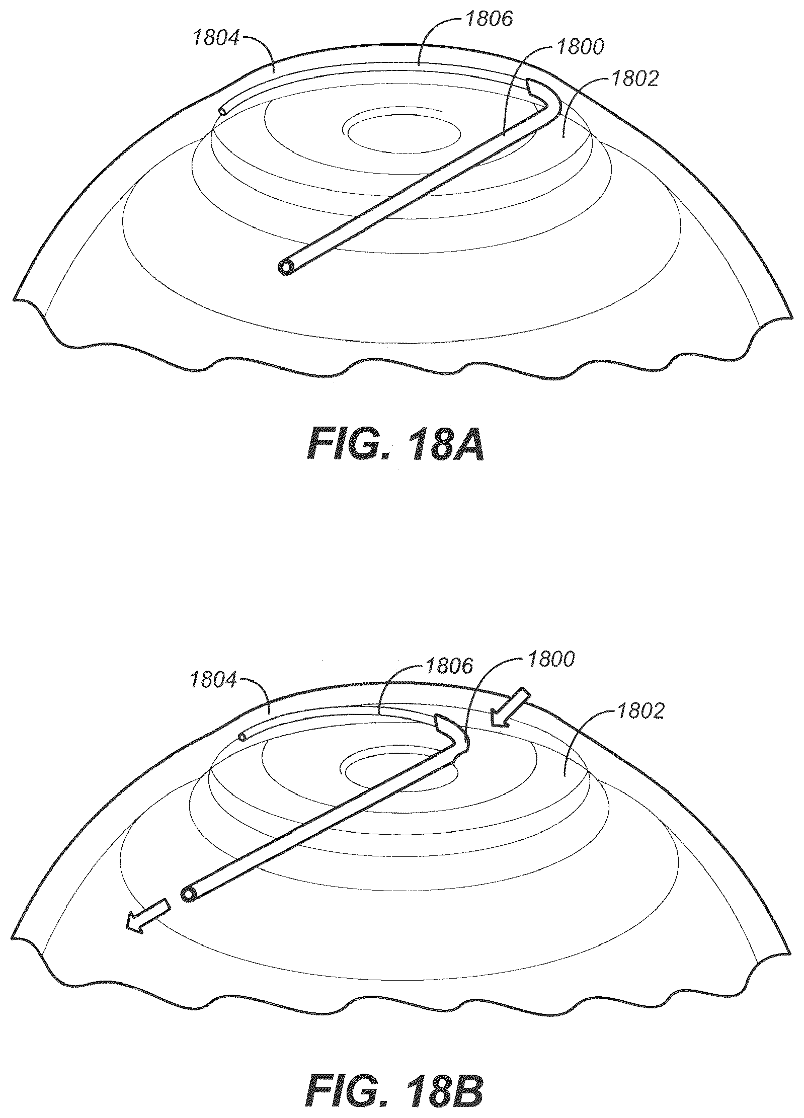 Patent US12350192 Figure 20 – Ocular delivery systems and methods