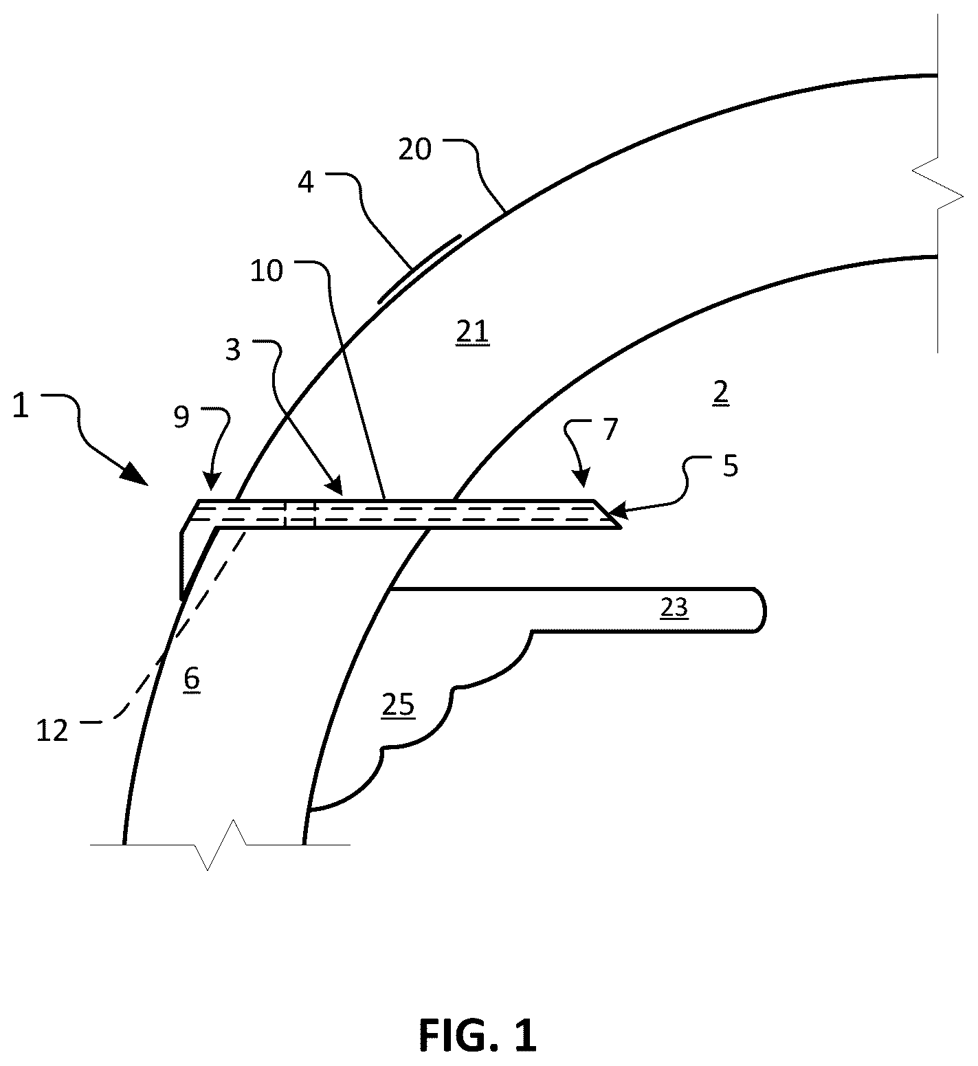 Patent US12350193 Figure 1 – Dry eye treatment devices and methods