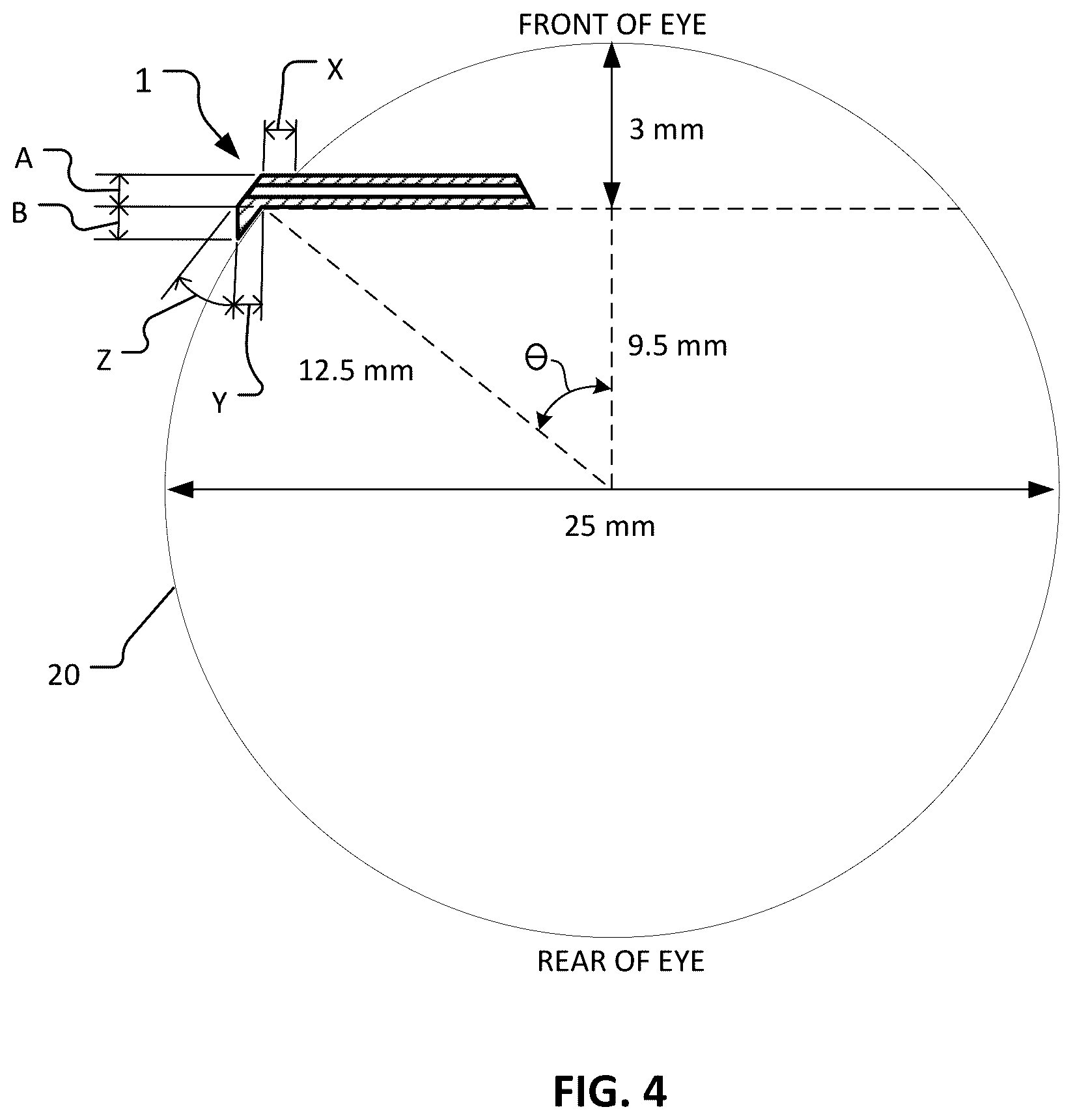 Patent US12350193 Figure 3 – Dry eye treatment devices and methods