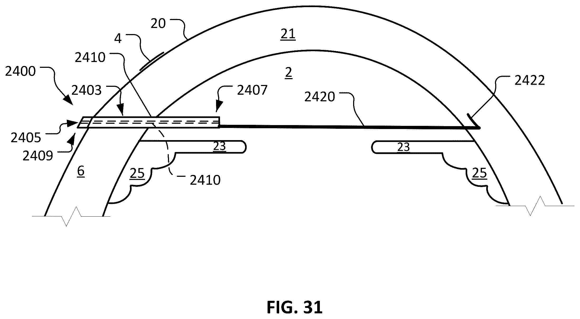 Patent US12350193 Figure 16 – Dry eye treatment devices and methods