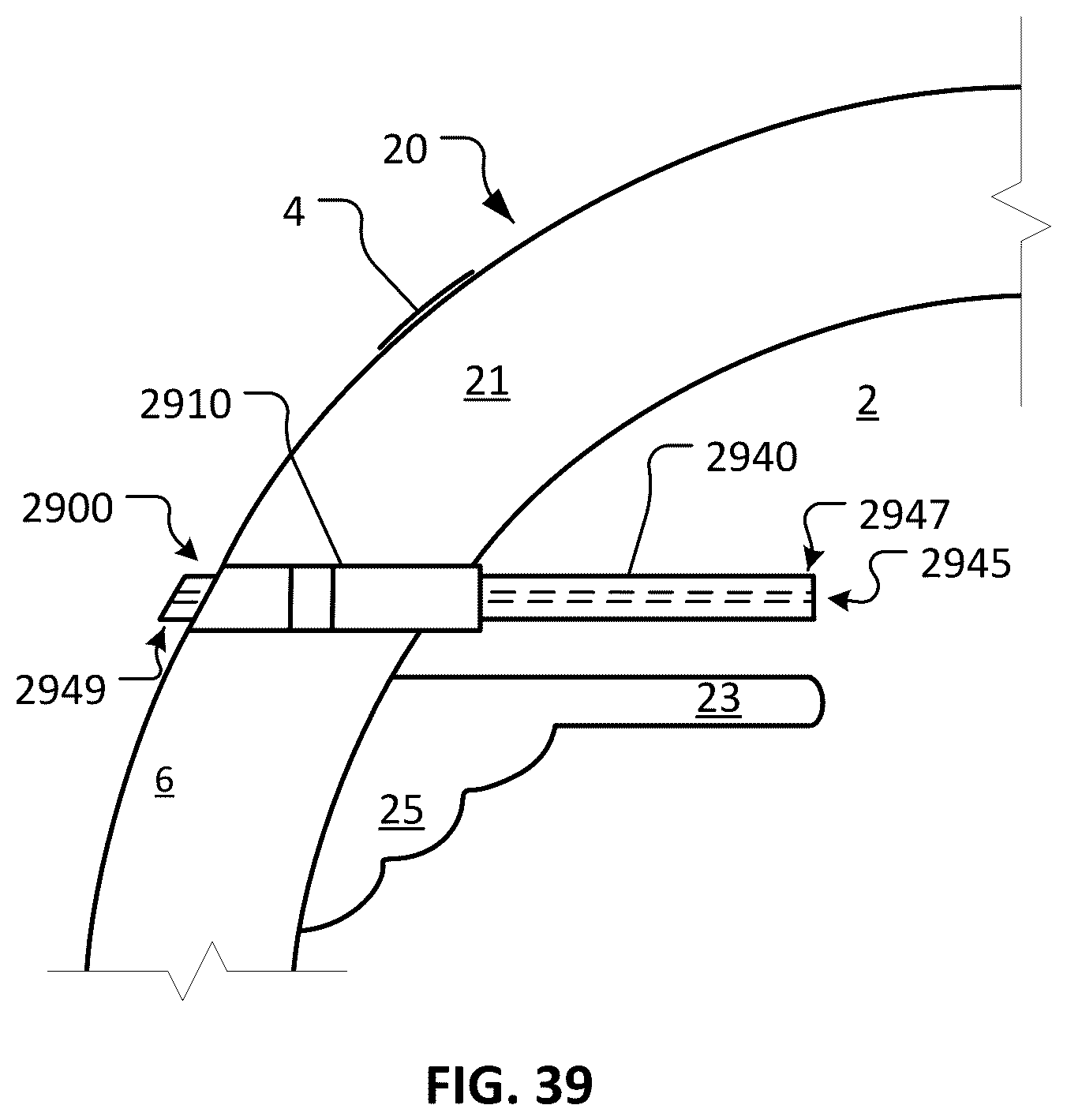 Patent US12350193 Figure 20 – Dry eye treatment devices and methods