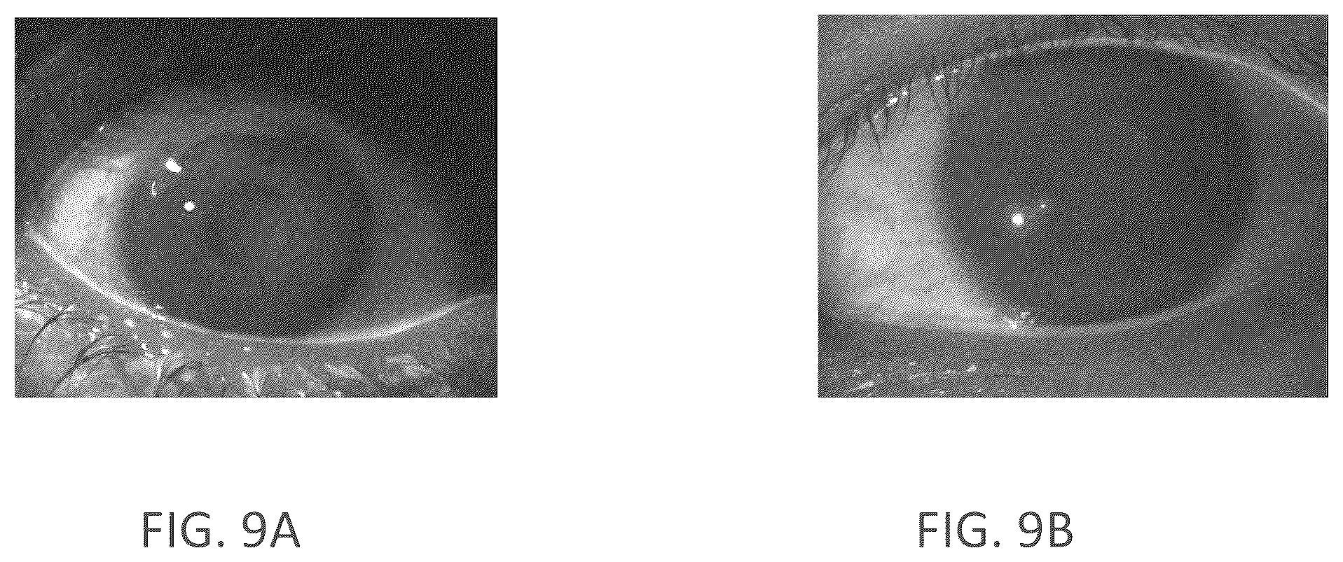 Patent US12350194 Figure 16 – Topical ocular delivery of fluids with controlled mass dosing and wireless communication