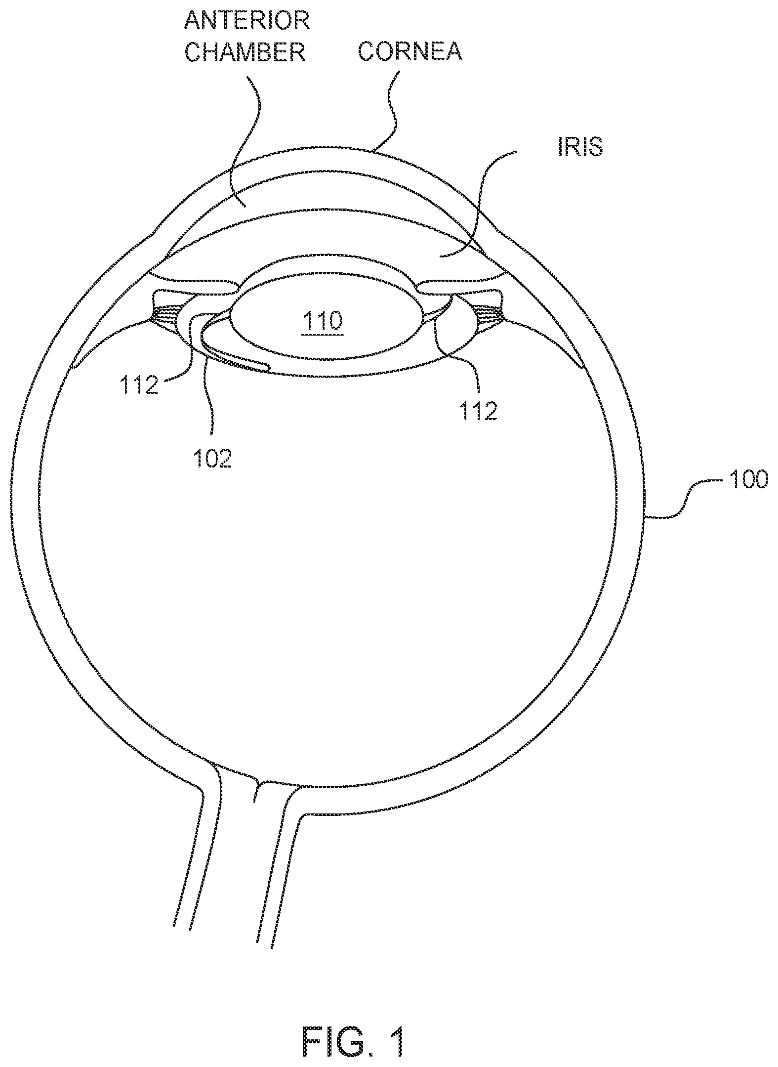 Patent US12350195 Figure 1 – Methods and apparatus for performing ocular biometry