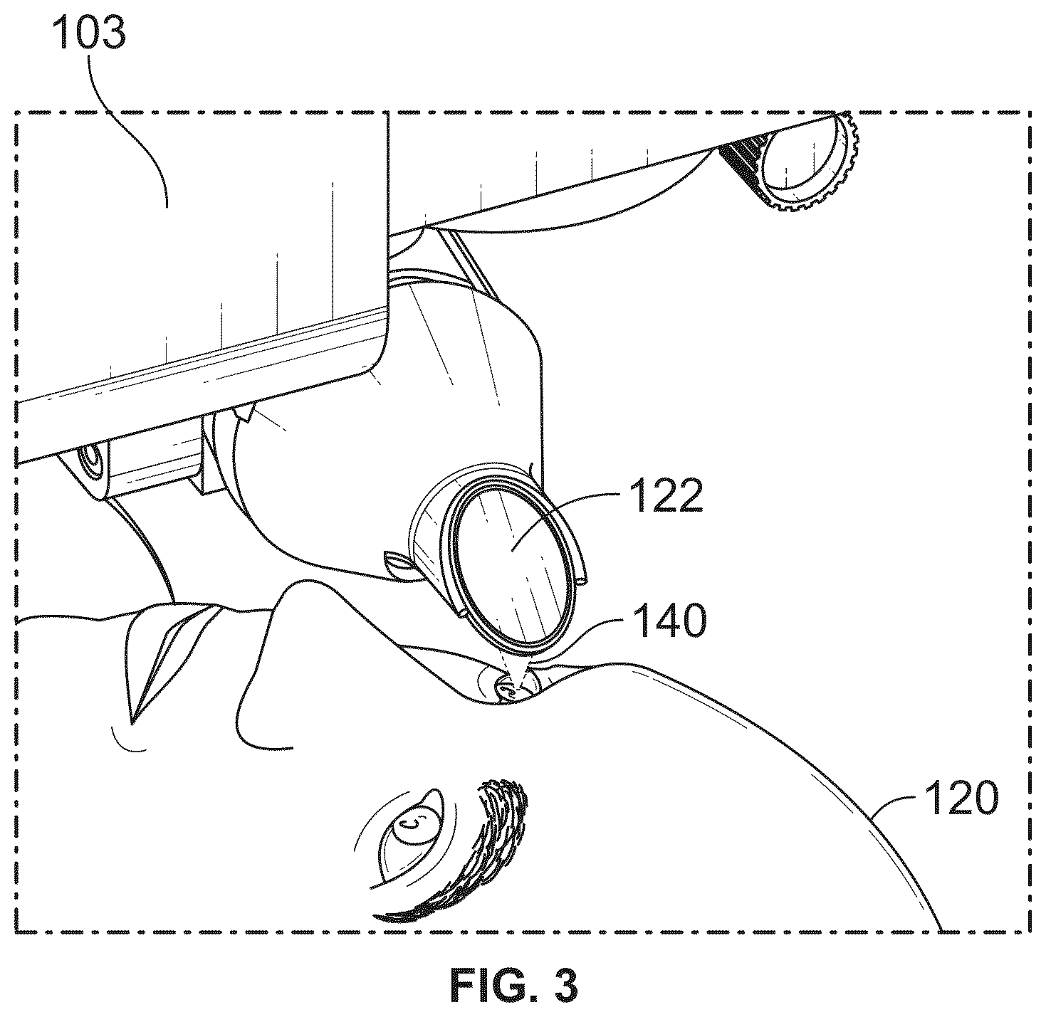 Patent US12350196 Figure 3 – Combined laser and phacoemulsification system for eye surgery