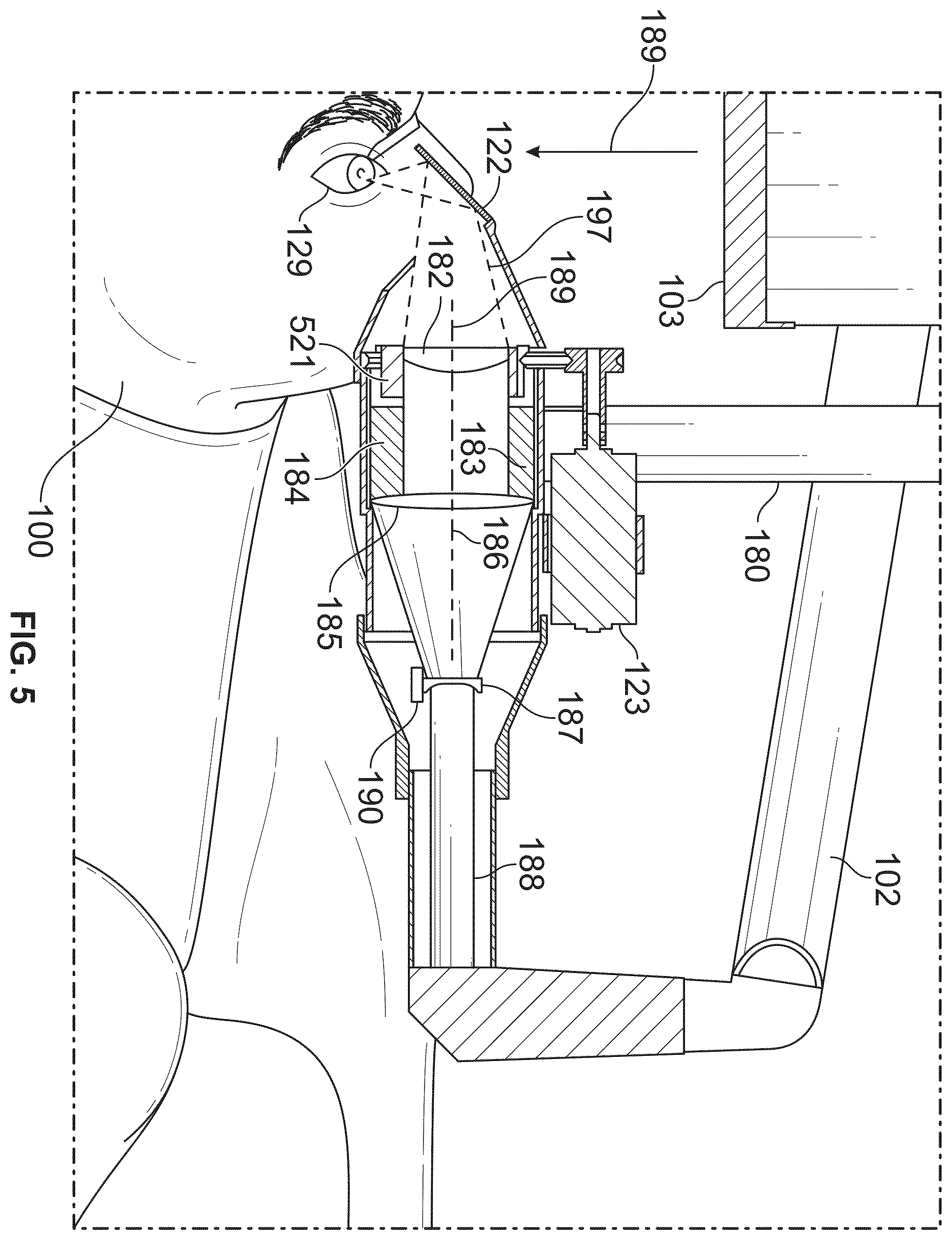 Patent US12350196 Figure 5 – Combined laser and phacoemulsification system for eye surgery