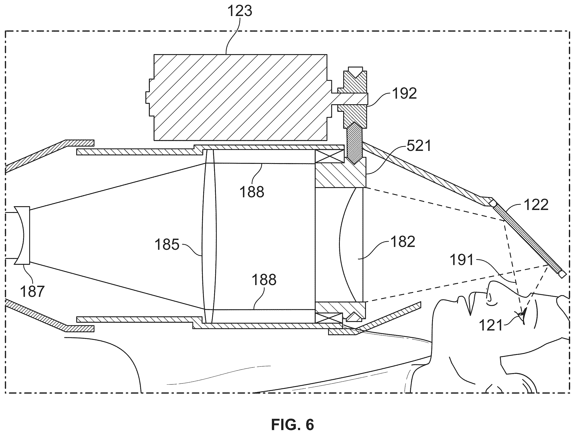 Patent US12350196 Figure 6 – Combined laser and phacoemulsification system for eye surgery