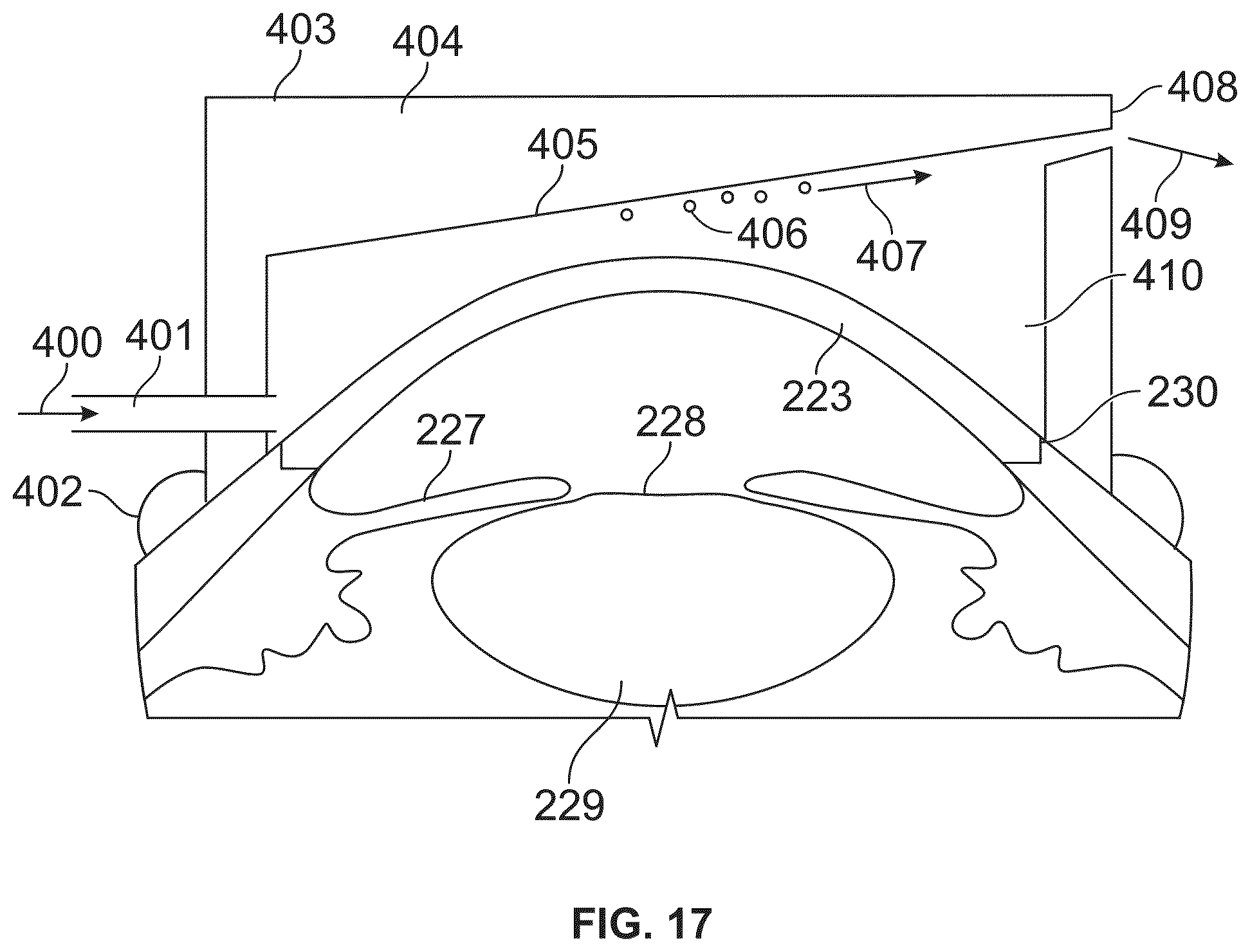 Patent US12350196 Figure 16 – Combined laser and phacoemulsification system for eye surgery