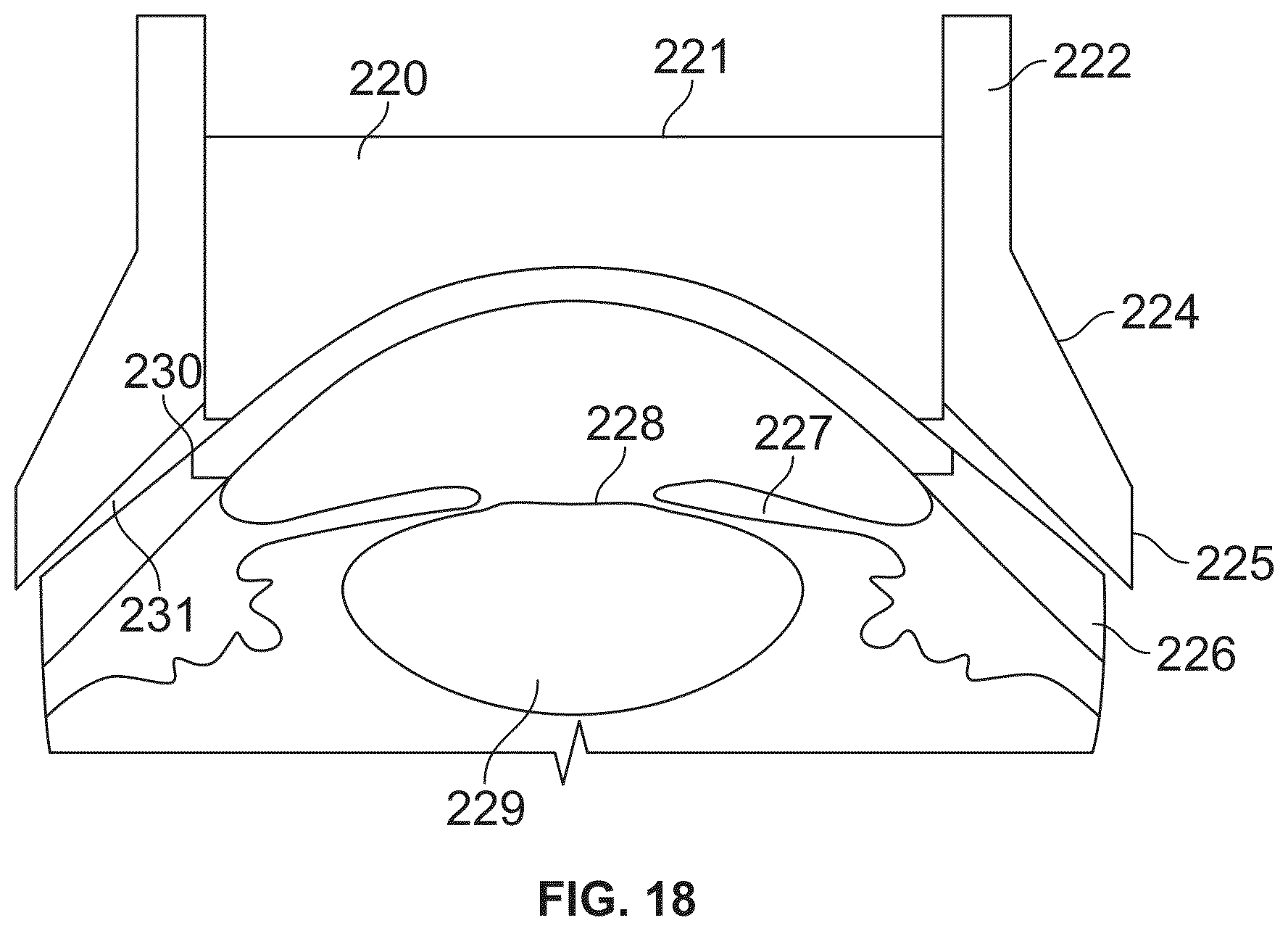 Patent US12350196 Figure 17 – Combined laser and phacoemulsification system for eye surgery