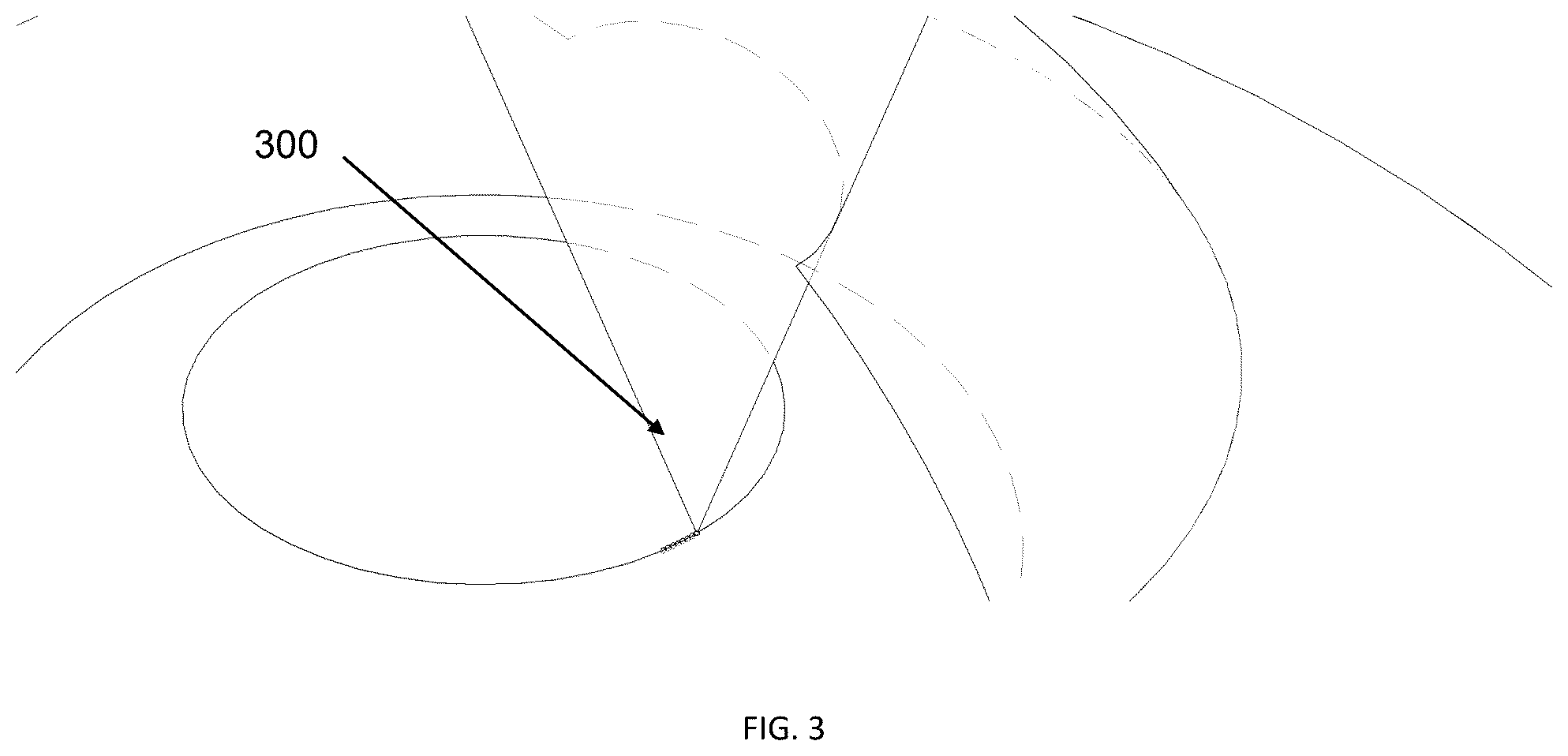 Patent US12350198 Figure 3 – Systems for laser eye surgery