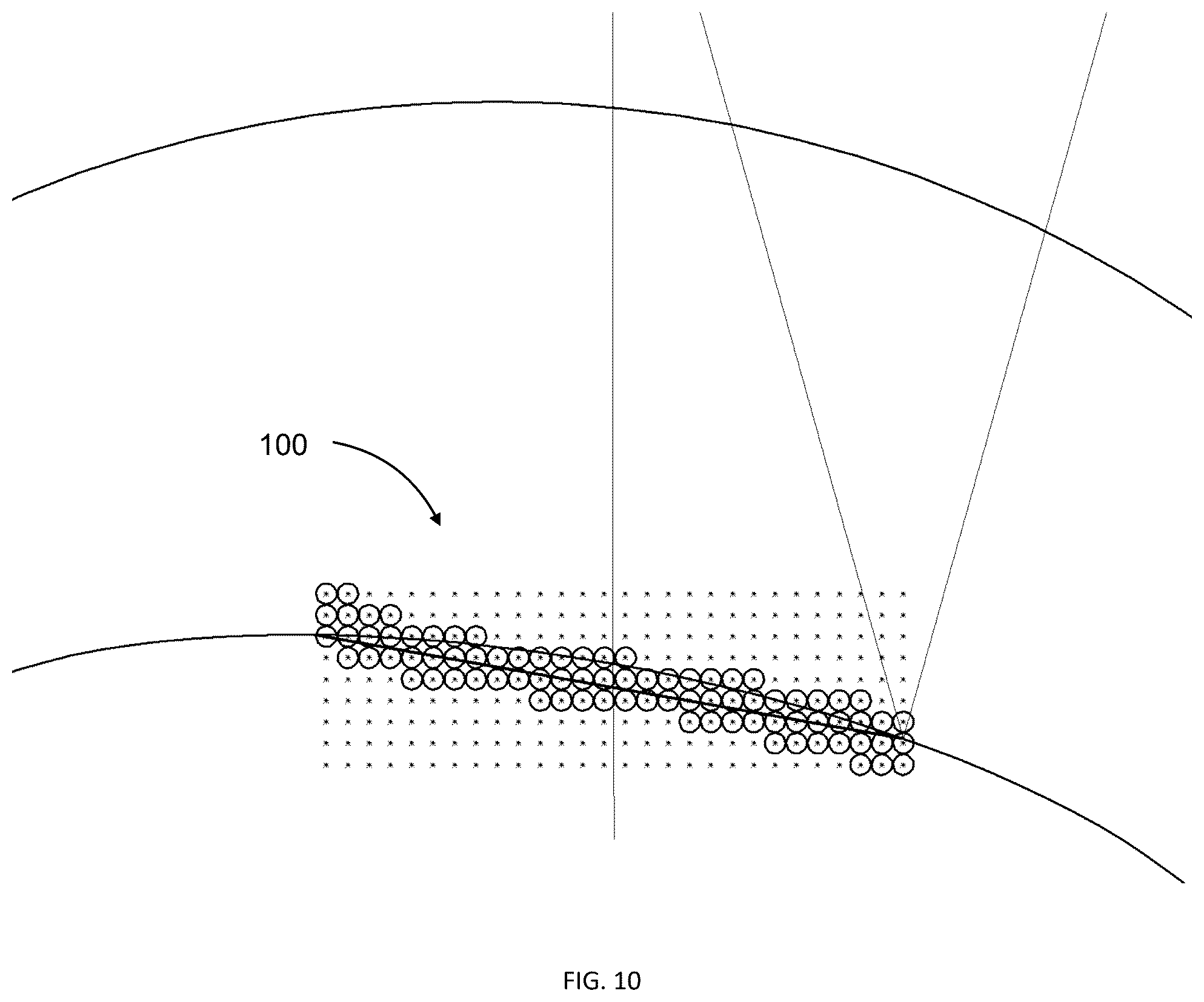 Patent US12350198 Figure 11 – Systems for laser eye surgery