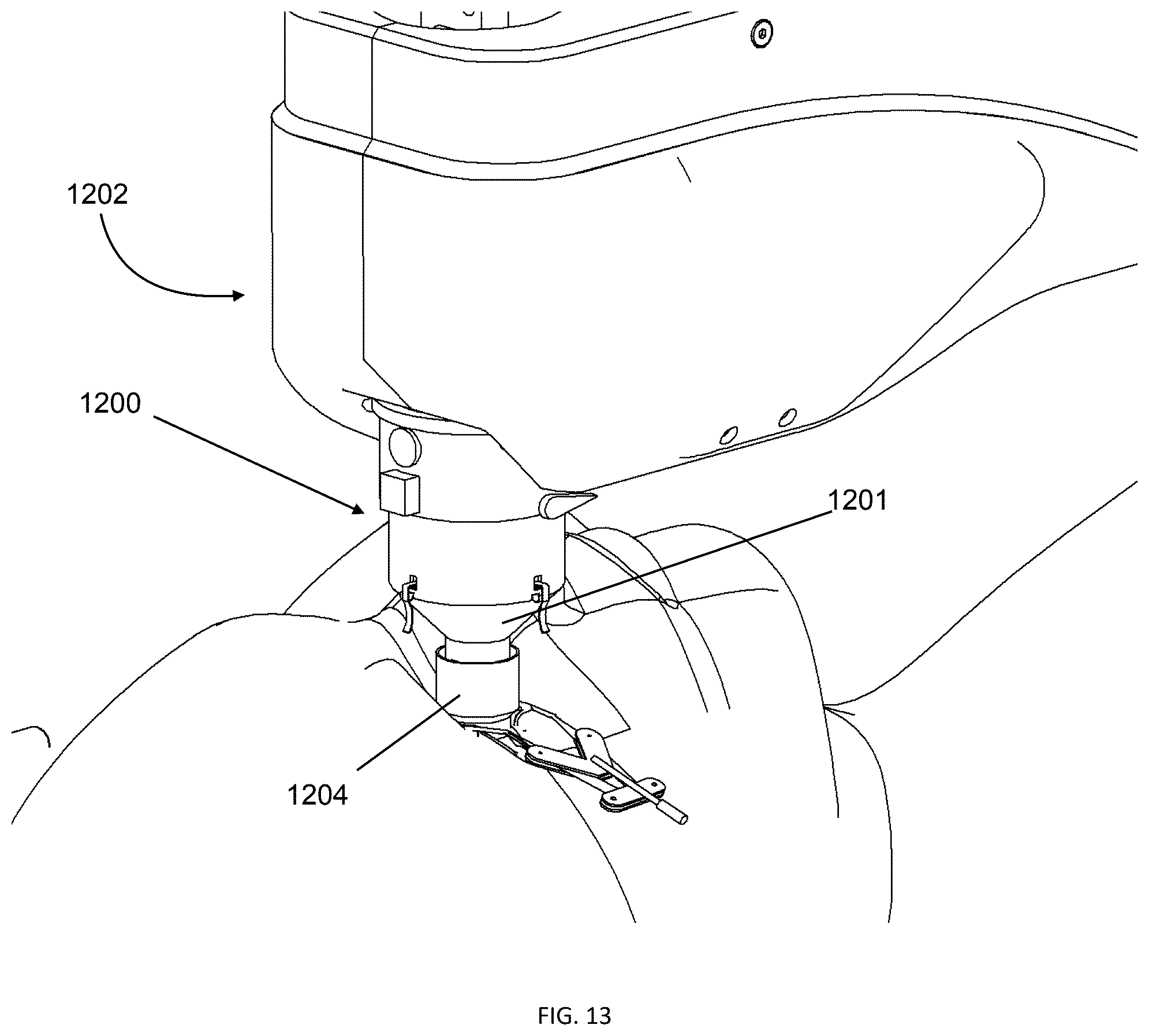 Patent US12350198 Figure 14 – Systems for laser eye surgery