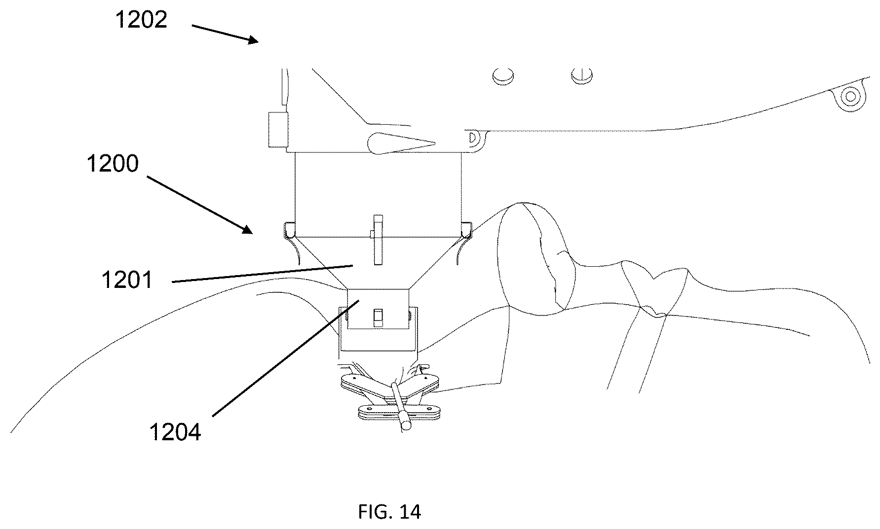 Patent US12350198 Figure 15 – Systems for laser eye surgery