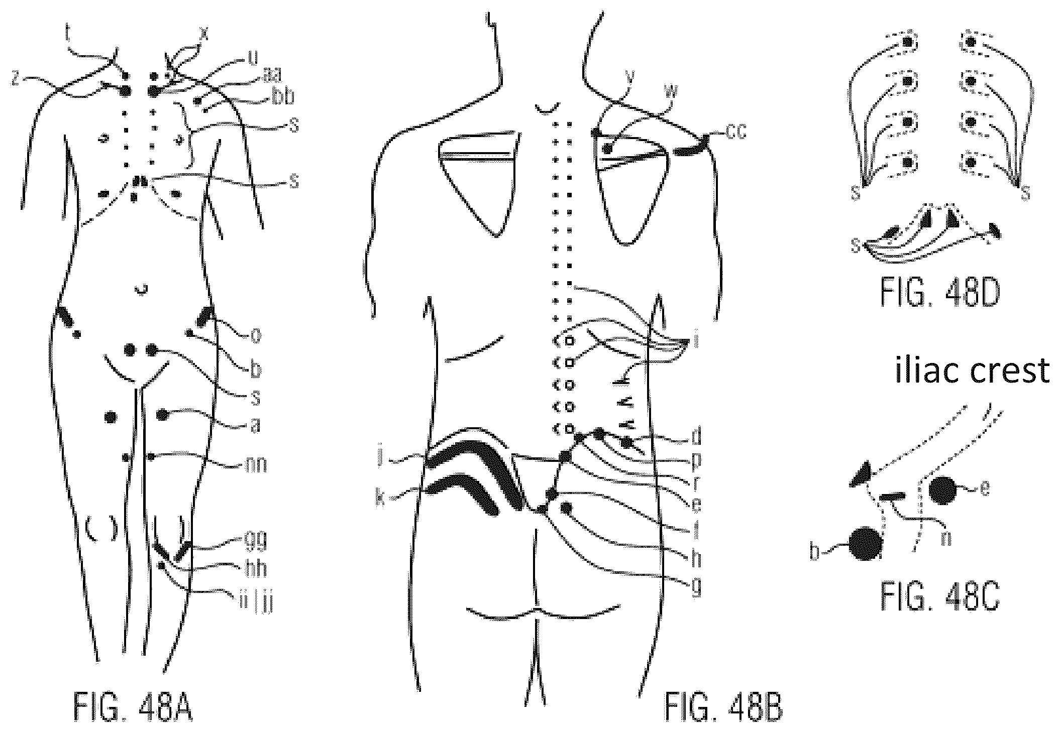 Patent US12350217 Figure 20 – Chair, pressing device
