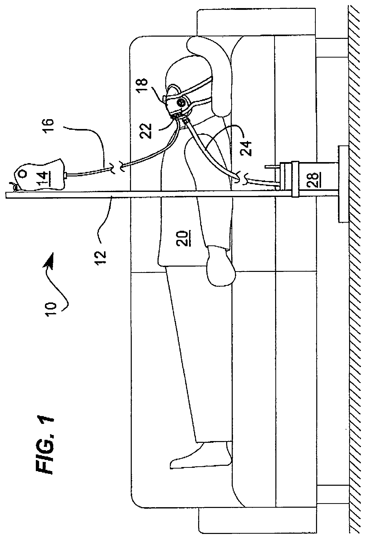 Patent US12350228 Figure 1 – System and device for irrigating and cleaning nasal cavities