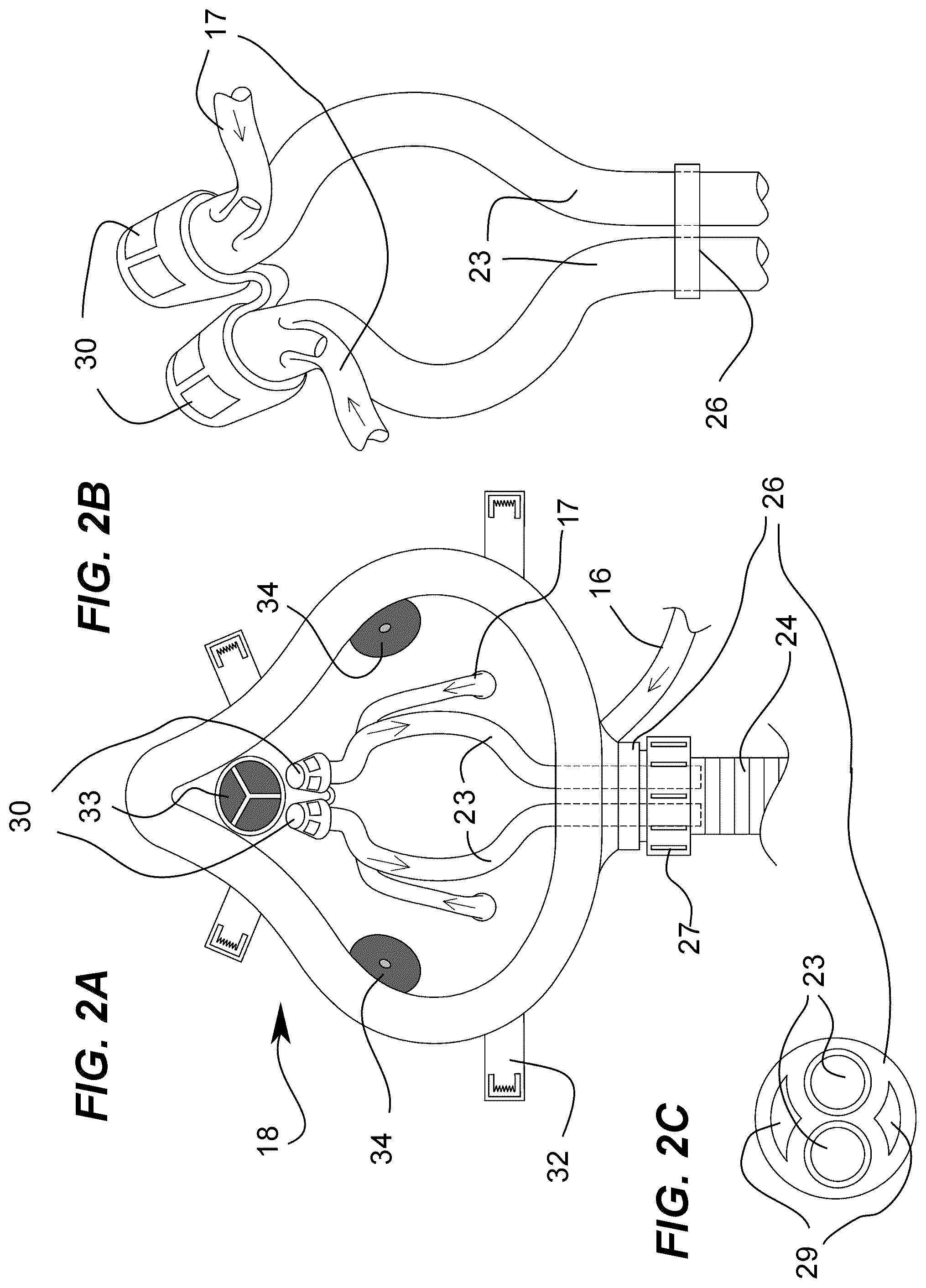 Patent US12350228 Figure 2 – System and device for irrigating and cleaning nasal cavities