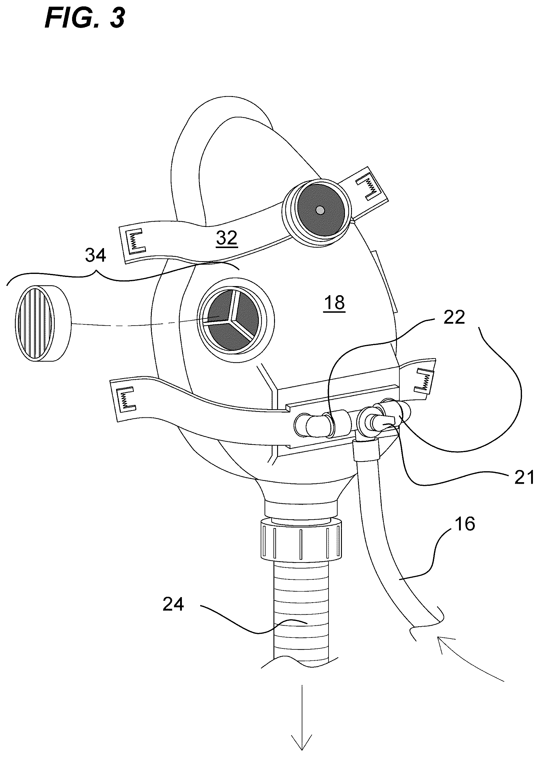 Patent US12350228 Figure 3 – System and device for irrigating and cleaning nasal cavities