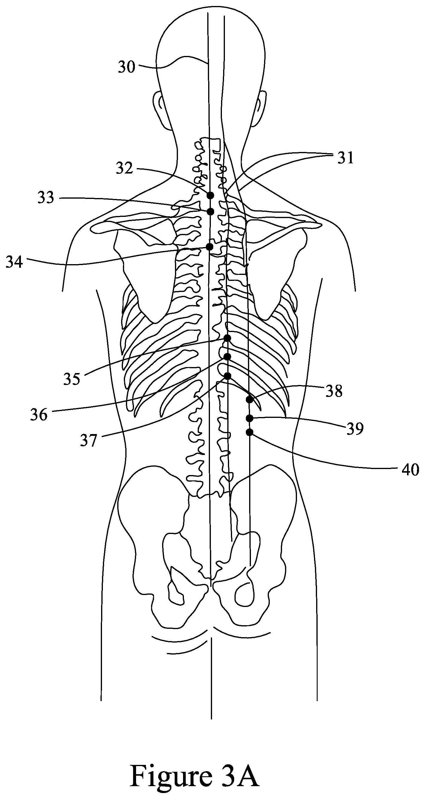 Patent US12350229 Figure 3 – Device, body, method and system for health-care