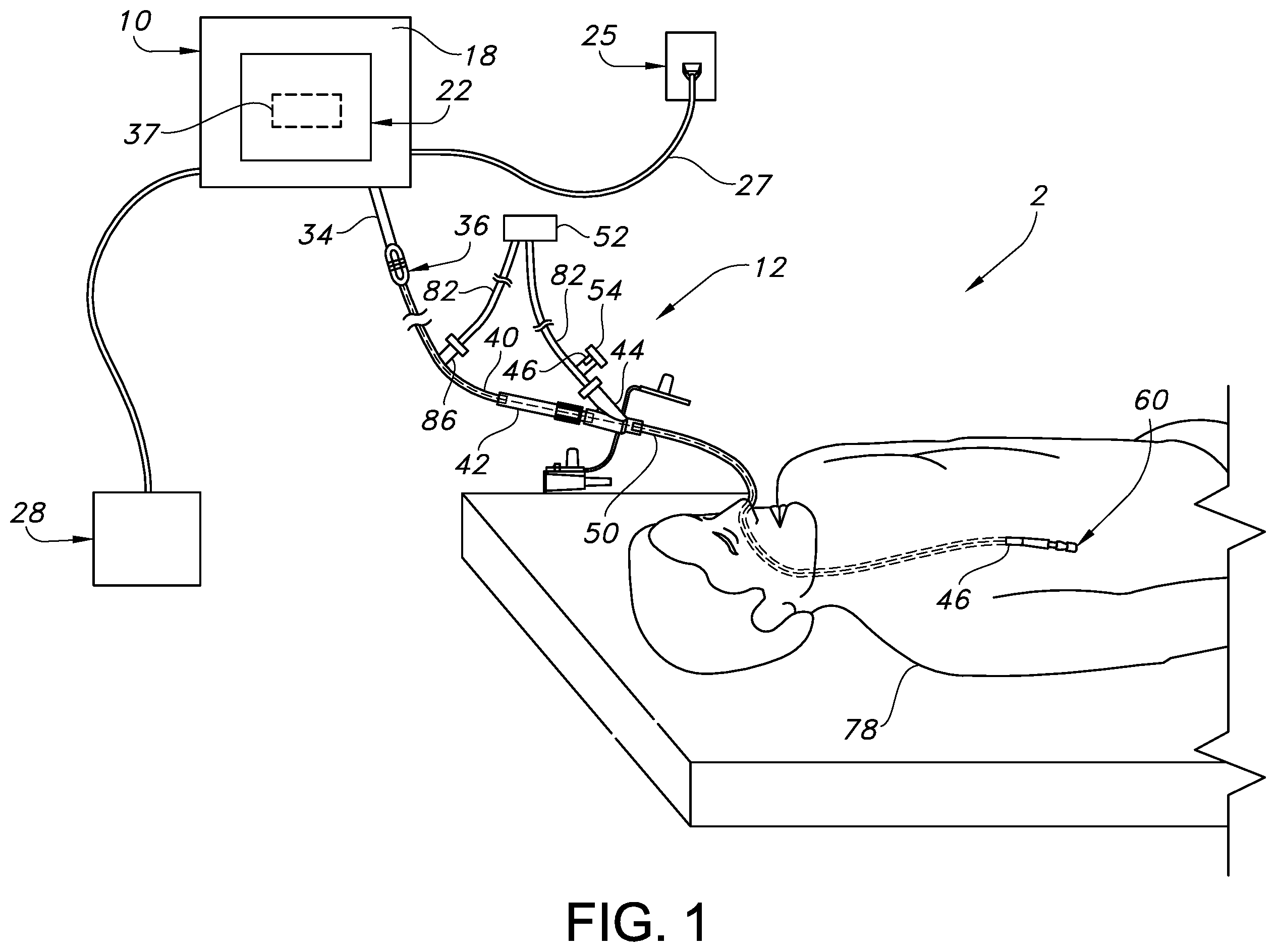 Patent US12350238 Figure 1 – System and method for real-time humidity and temperature sensing to verify proper nasogastric tube placement