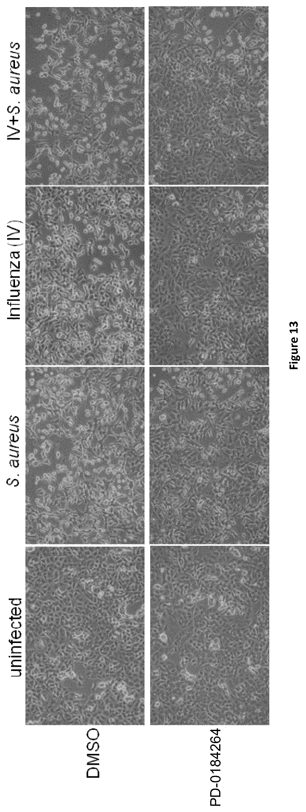 Patent US12350244 Figure 17 – MEK-inhibitor for the treatment of viral and bacterial infections