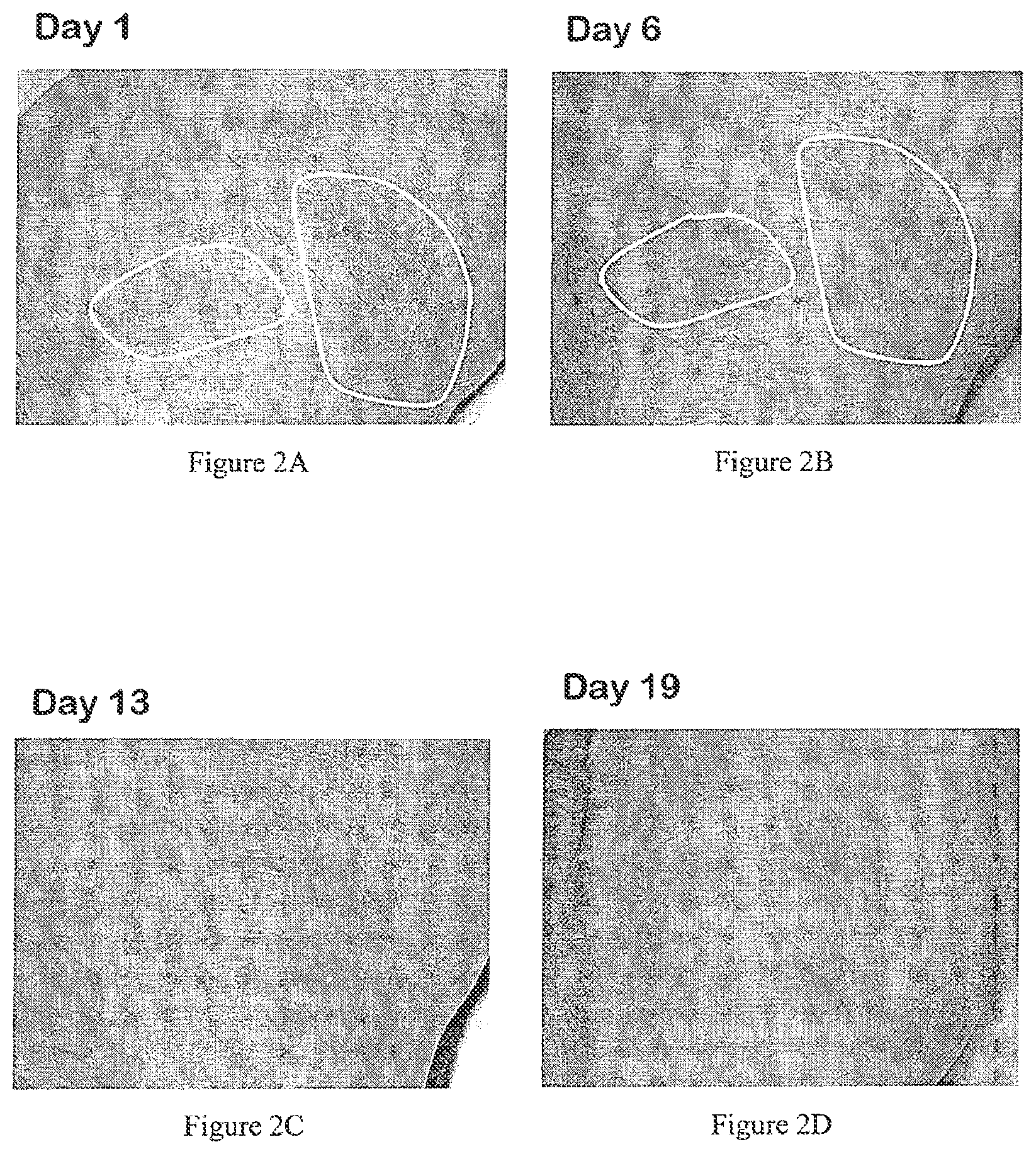 Patent US12350256 Figure 2 – Histidine and/or histidine derivative for the treatment of inflammatory skin diseases