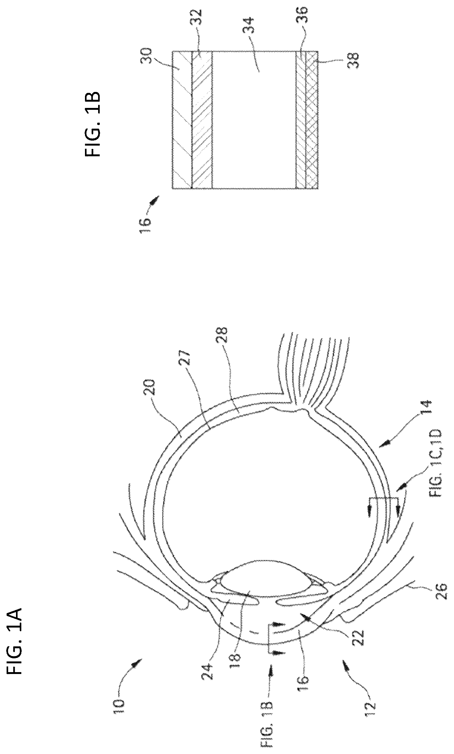 Patent US12350261 Figure 1 – Methods and devices for the treatment of ocular diseases in human subjects