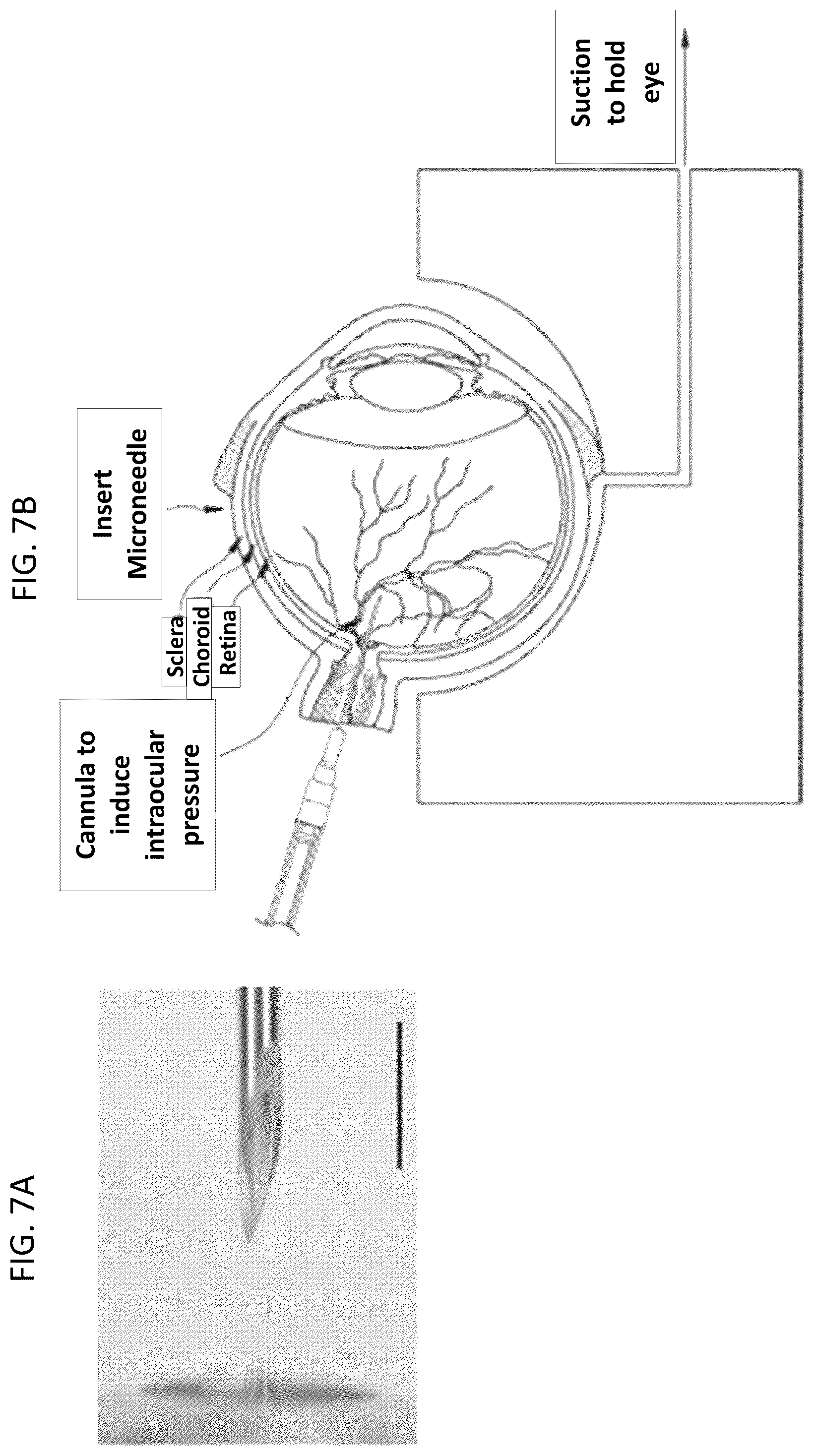 Patent US12350261 Figure 6 – Methods and devices for the treatment of ocular diseases in human subjects