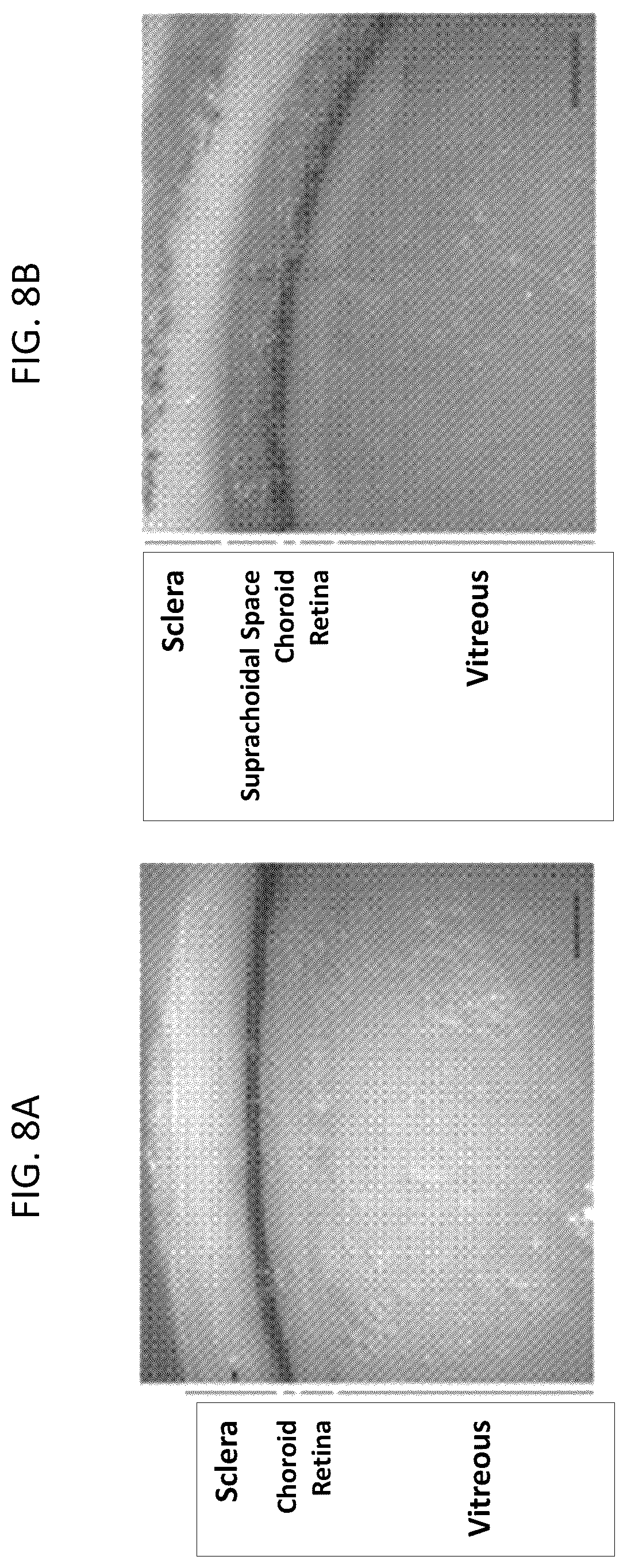Patent US12350261 Figure 7 – Methods and devices for the treatment of ocular diseases in human subjects