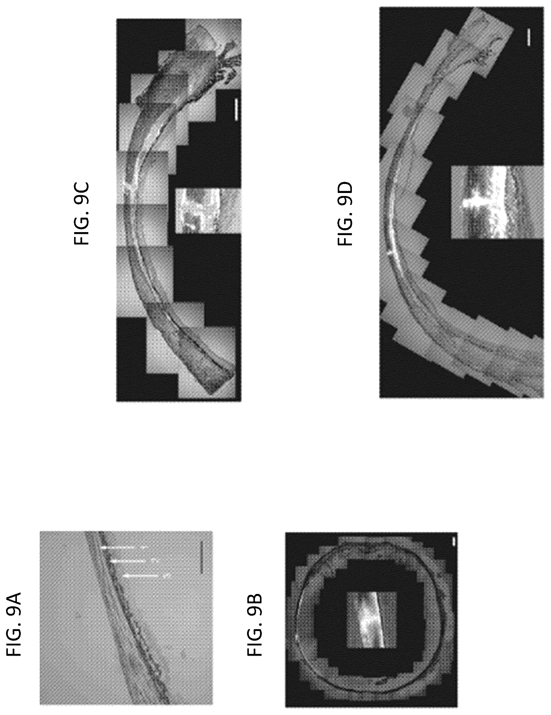 Patent US12350261 Figure 8 – Methods and devices for the treatment of ocular diseases in human subjects