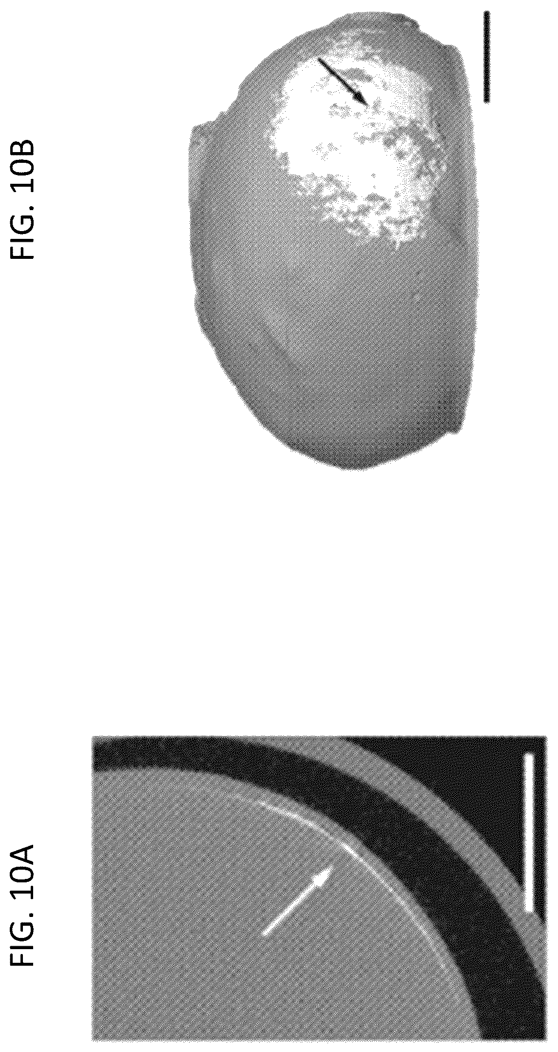 Patent US12350261 Figure 9 – Methods and devices for the treatment of ocular diseases in human subjects