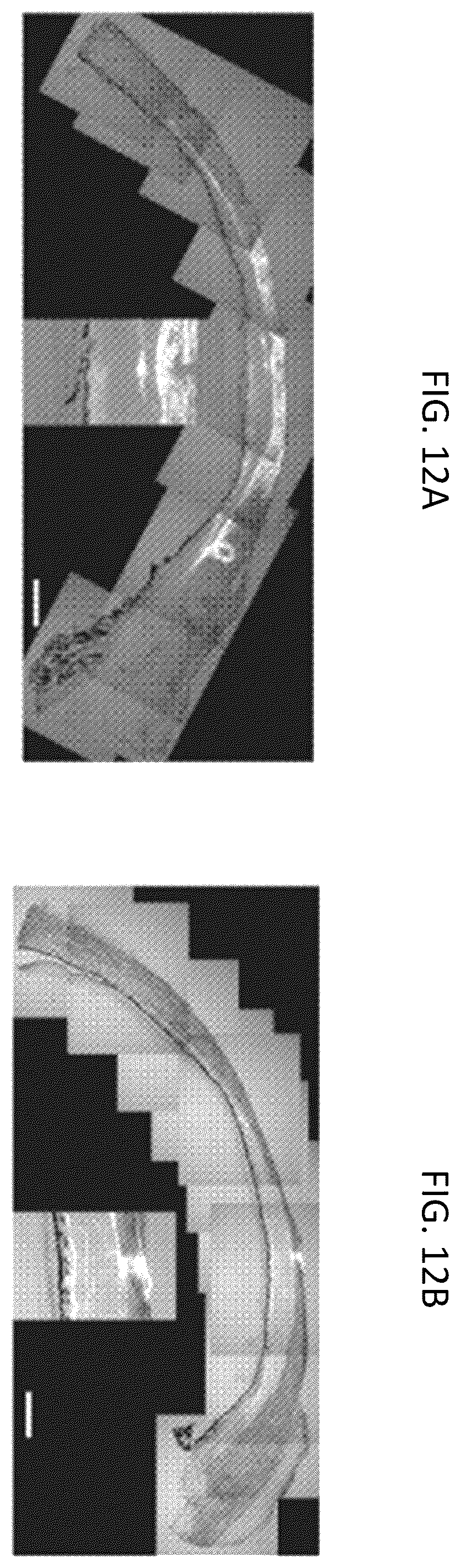 Patent US12350261 Figure 12 – Methods and devices for the treatment of ocular diseases in human subjects