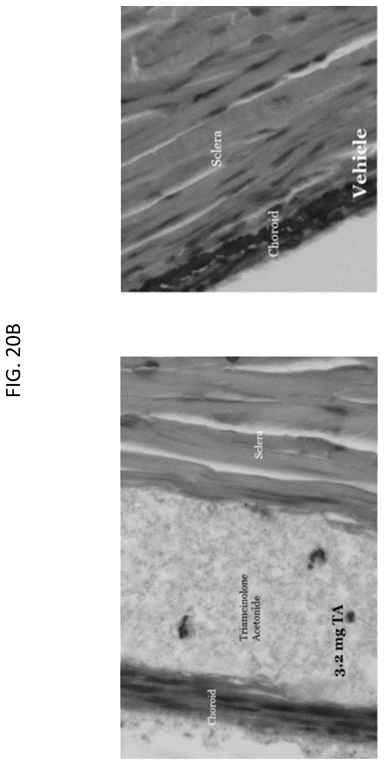 Patent US12350261 Figure 20 – Methods and devices for the treatment of ocular diseases in human subjects