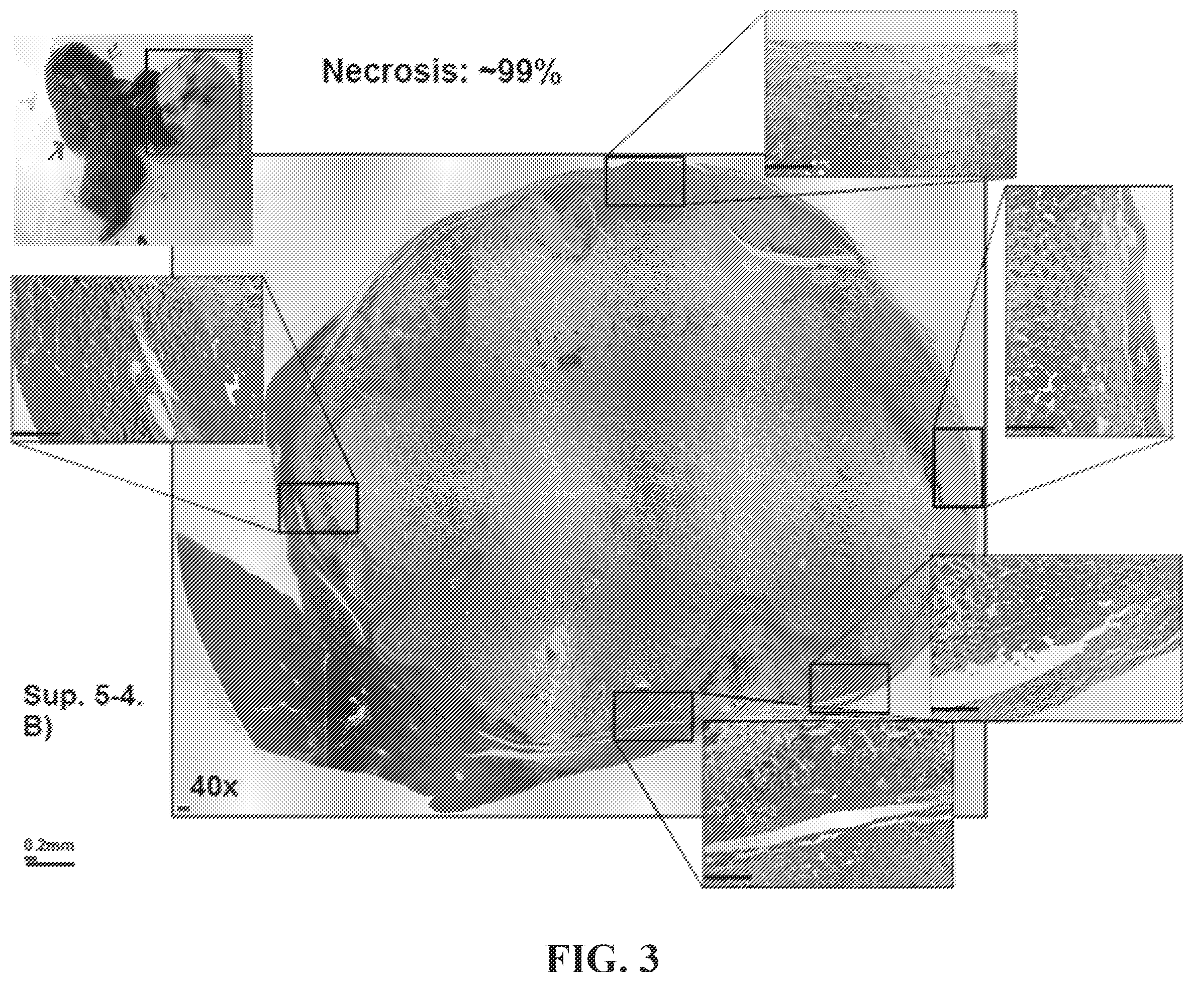 Patent US12350275 Figure 4 – Compositions and methods for immune-mediated cancer therapy