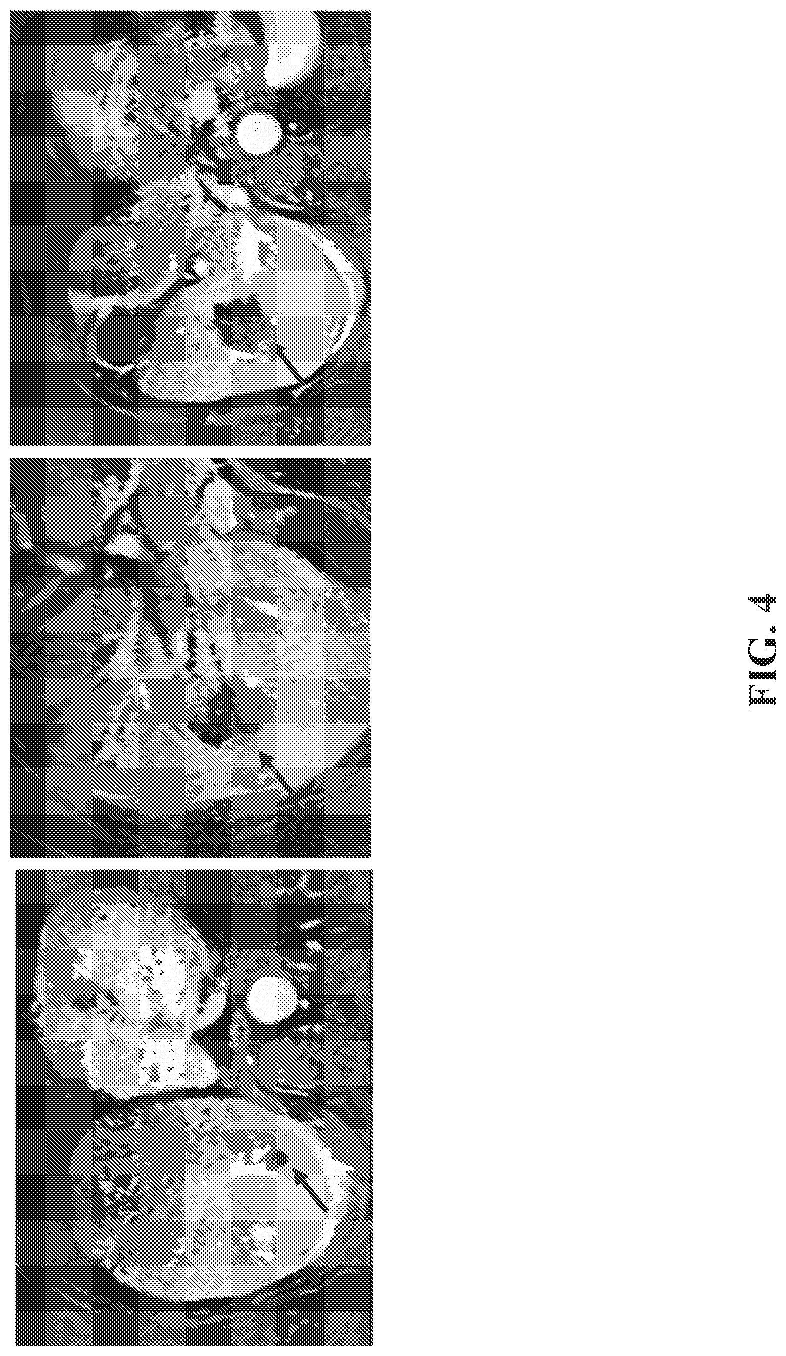 Patent US12350275 Figure 5 – Compositions and methods for immune-mediated cancer therapy
