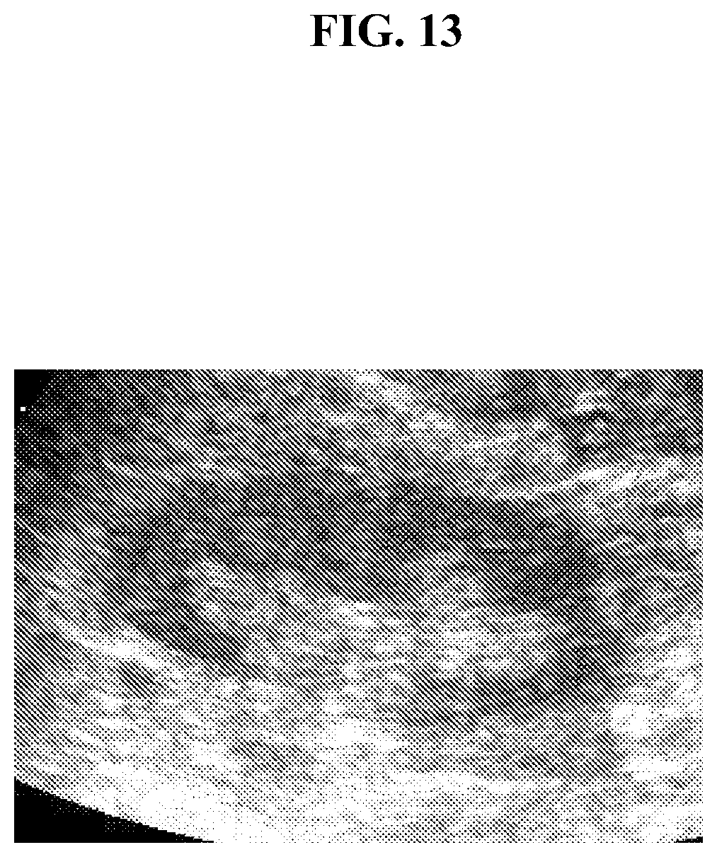 Patent US12350292 Figure 20 – Bioactive renal cells for the treatment of chronic kidney disease