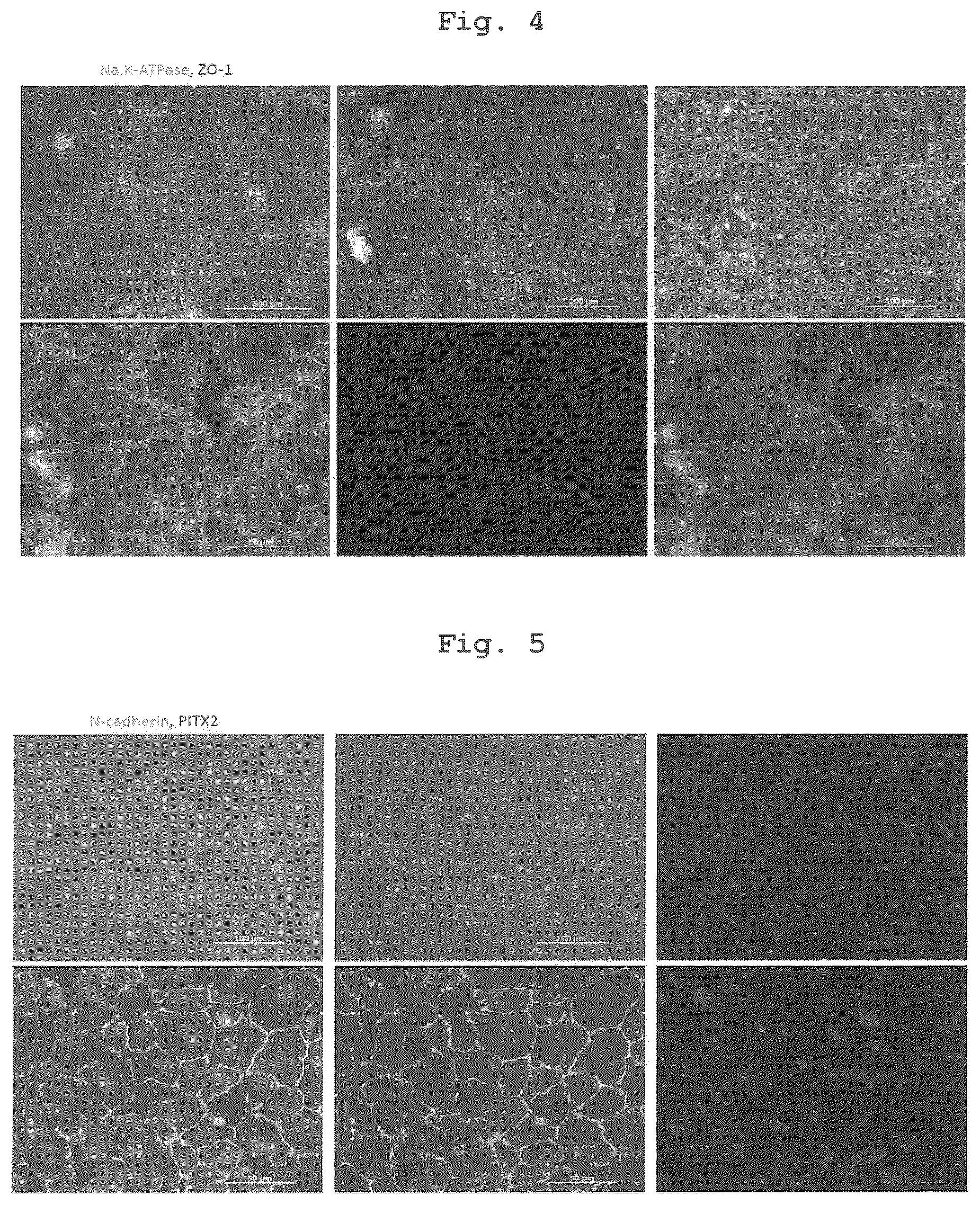Patent US12350294 Figure 4 – Medium comprising serum replacement, IGF1, STAT3 activator and adrenal gland hormone without BFGF or rock inhibitor for producing corneal endothelial substitute cells from iPS cells and a method thereof