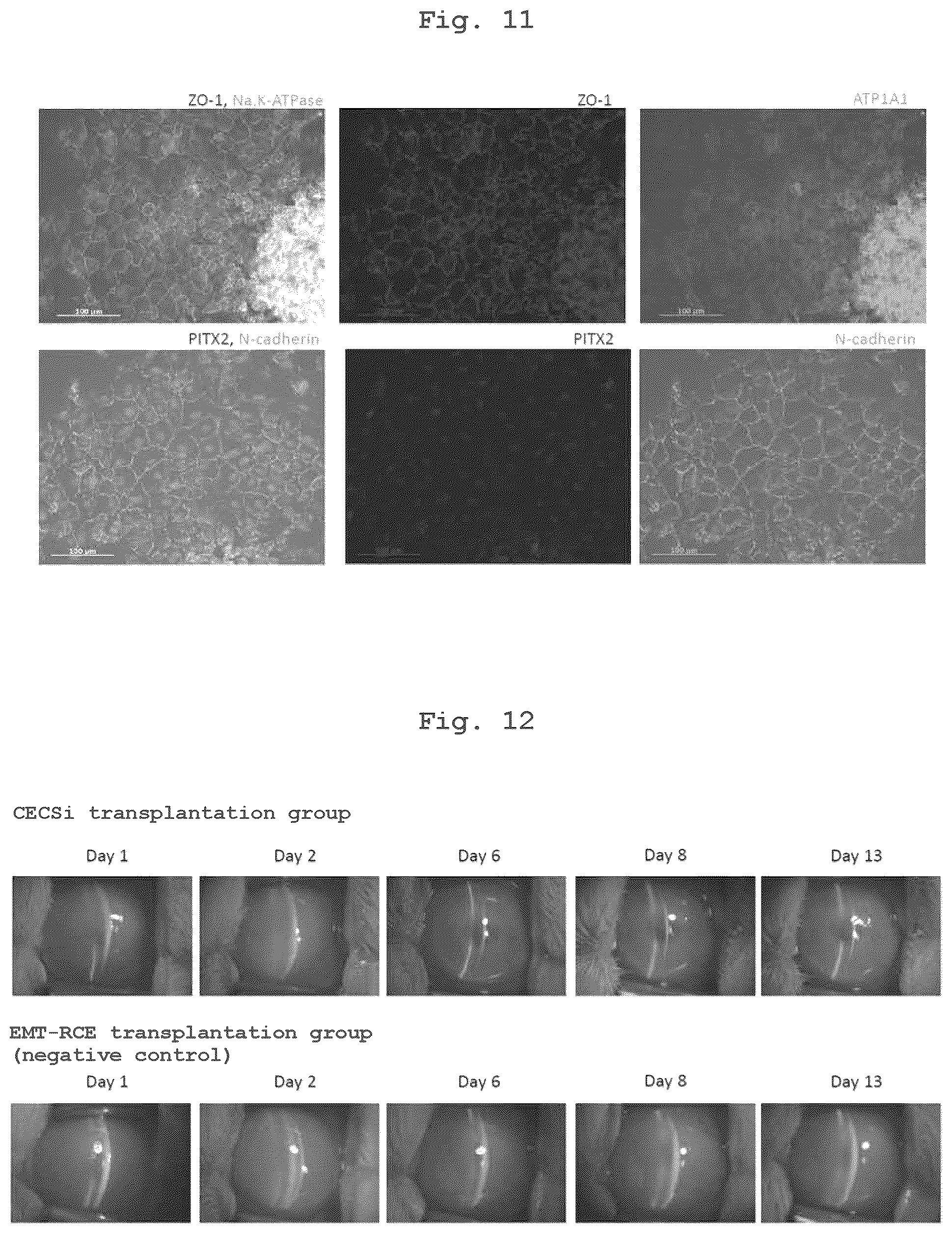 Patent US12350294 Figure 9 – Medium comprising serum replacement, IGF1, STAT3 activator and adrenal gland hormone without BFGF or rock inhibitor for producing corneal endothelial substitute cells from iPS cells and a method thereof