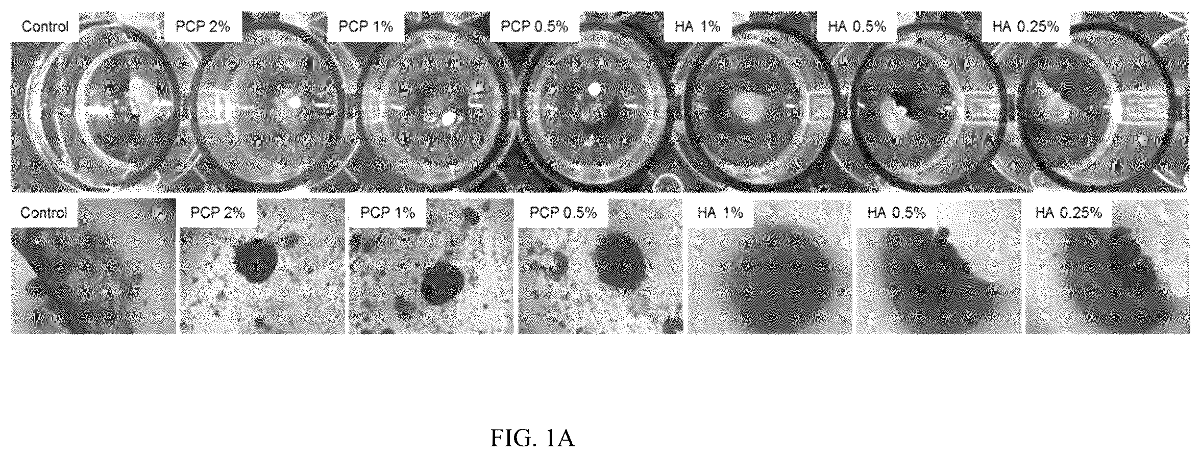 Patent US12350295 Figure 1 – Complex for promoting cartilage differentiation comprising cartilage cell-free crush and stem cell and use thereof