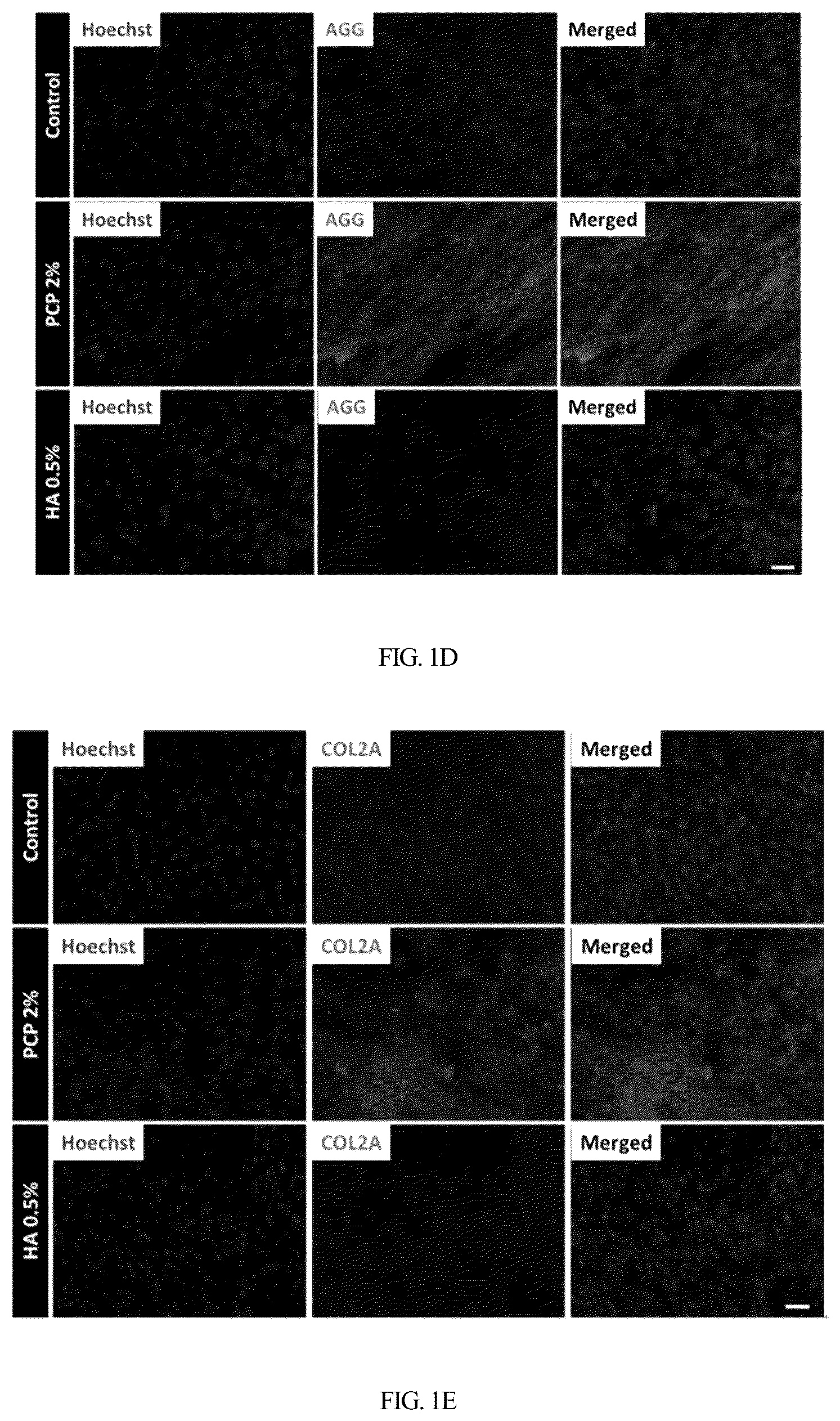 Patent US12350295 Figure 3 – Complex for promoting cartilage differentiation comprising cartilage cell-free crush and stem cell and use thereof