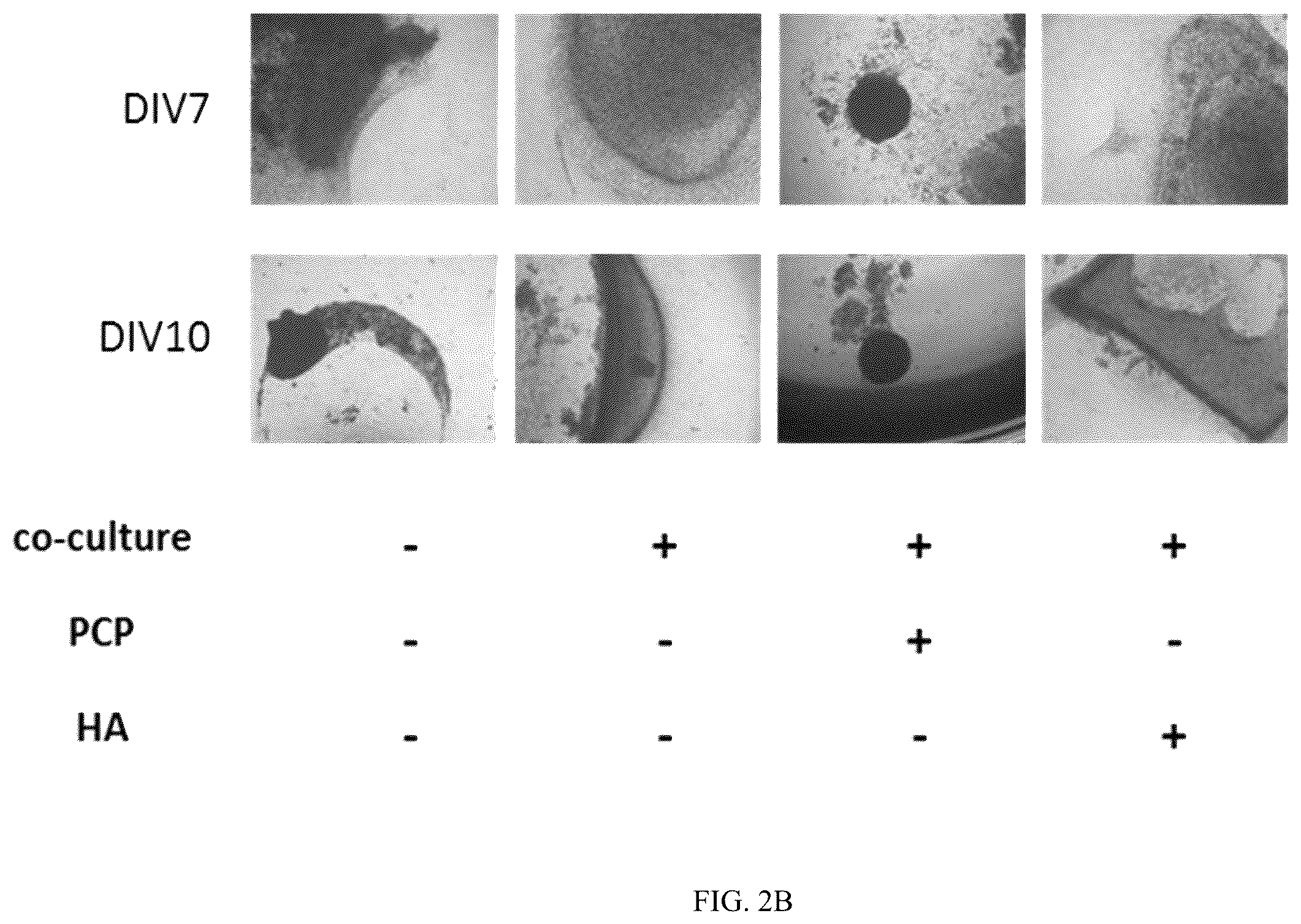 Patent US12350295 Figure 6 – Complex for promoting cartilage differentiation comprising cartilage cell-free crush and stem cell and use thereof