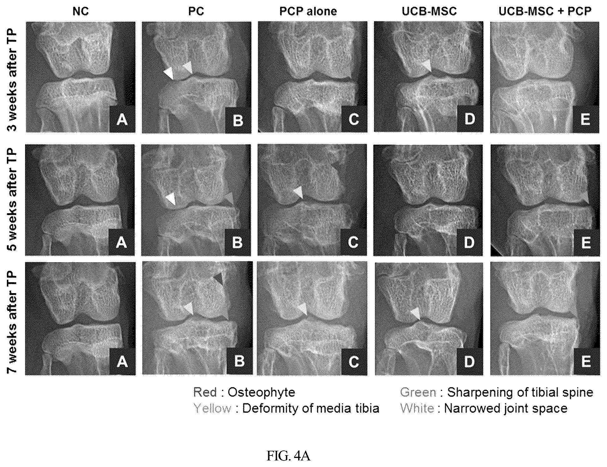 Patent US12350295 Figure 10 – Complex for promoting cartilage differentiation comprising cartilage cell-free crush and stem cell and use thereof