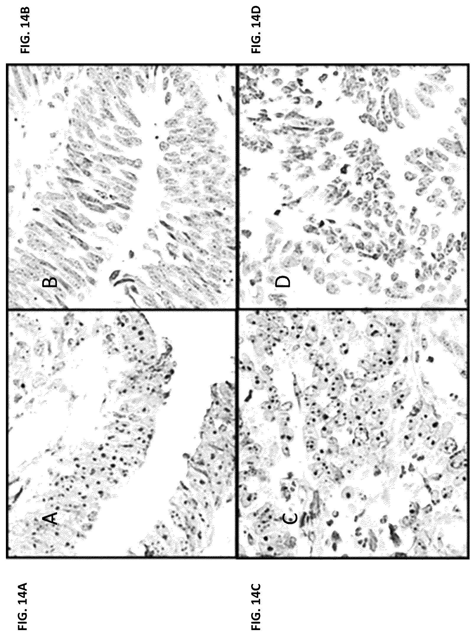 Patent US12350302 Figure 20 – Dosing regime and formulations for type B adenoviruses