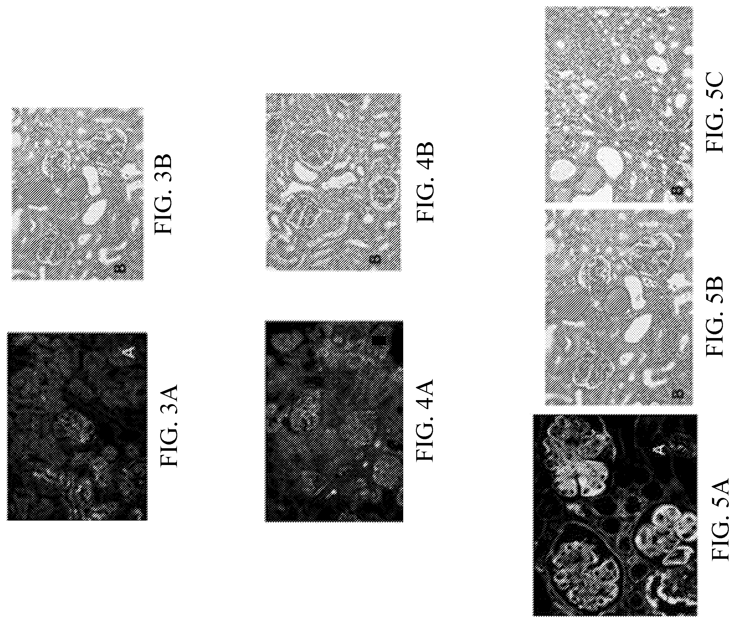 Patent US12350308 Figure 2 – Phosphorylcholine conjugates and uses thereof