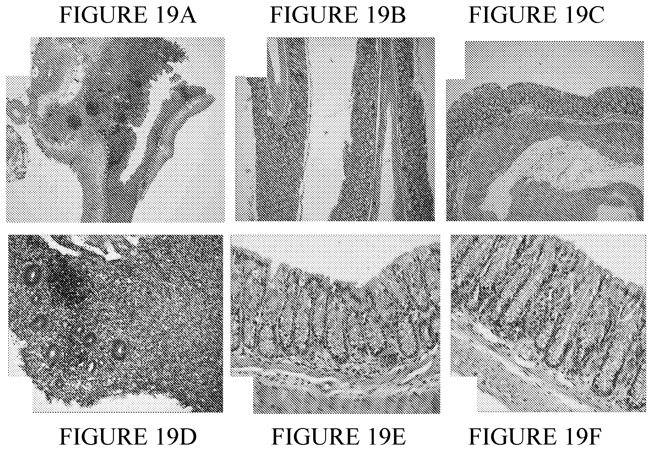 Patent US12350308 Figure 10 – Phosphorylcholine conjugates and uses thereof