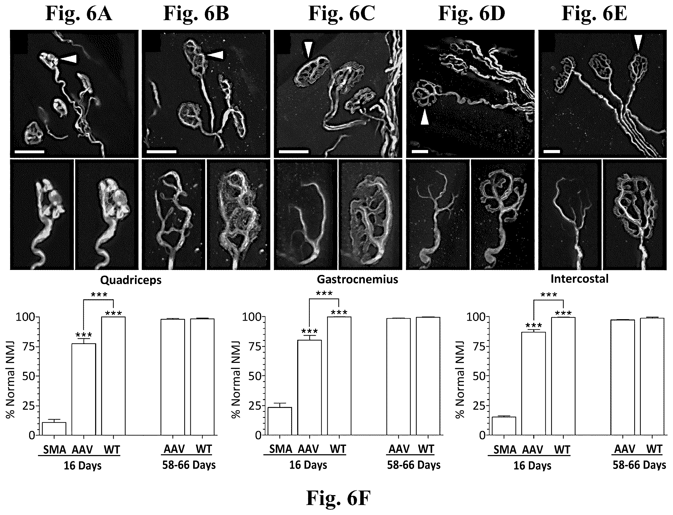 Patent US12350311 Figure 8 – Gene therapy for neurodegenerative disorders
