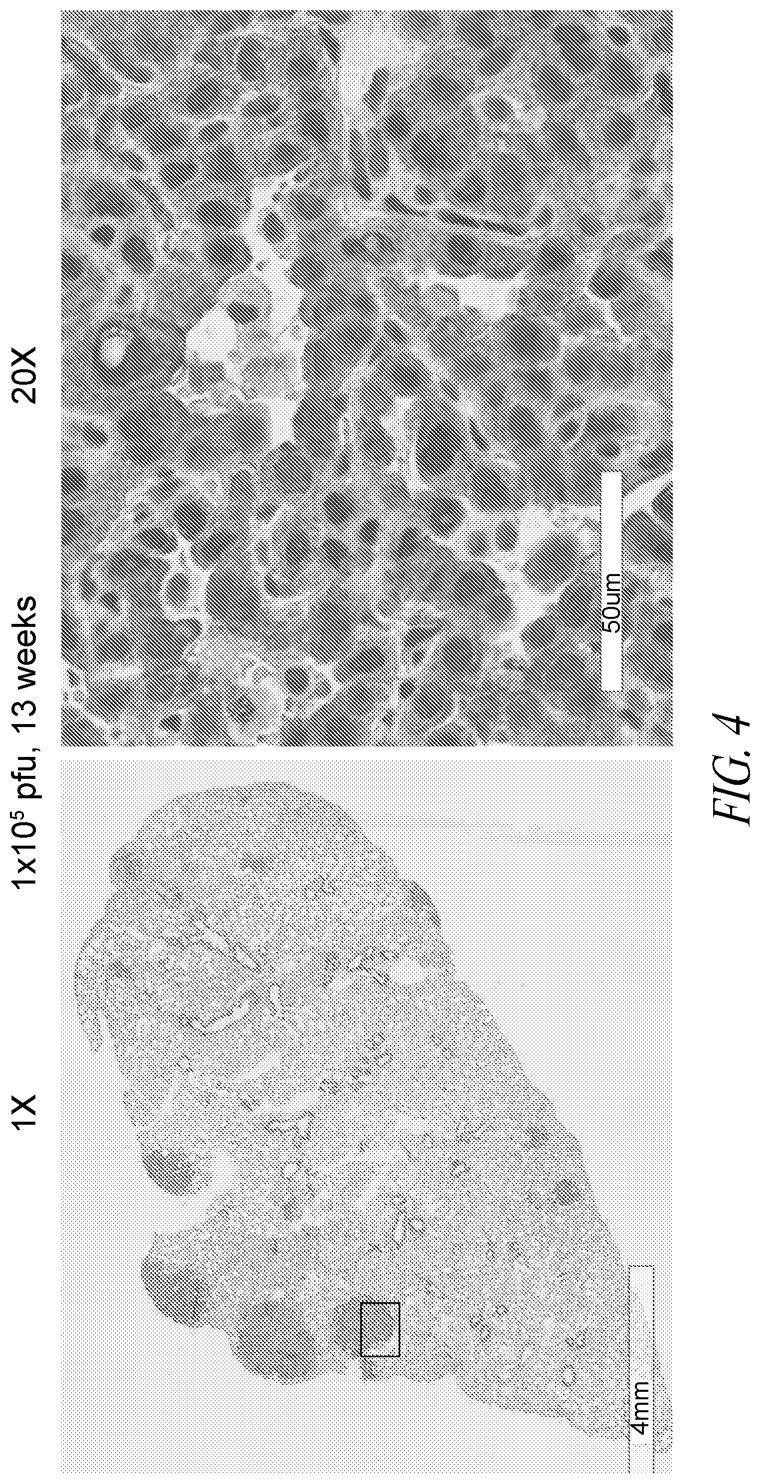 Patent US12350312 Figure 9 – Methods for improving adoptive cell therapy