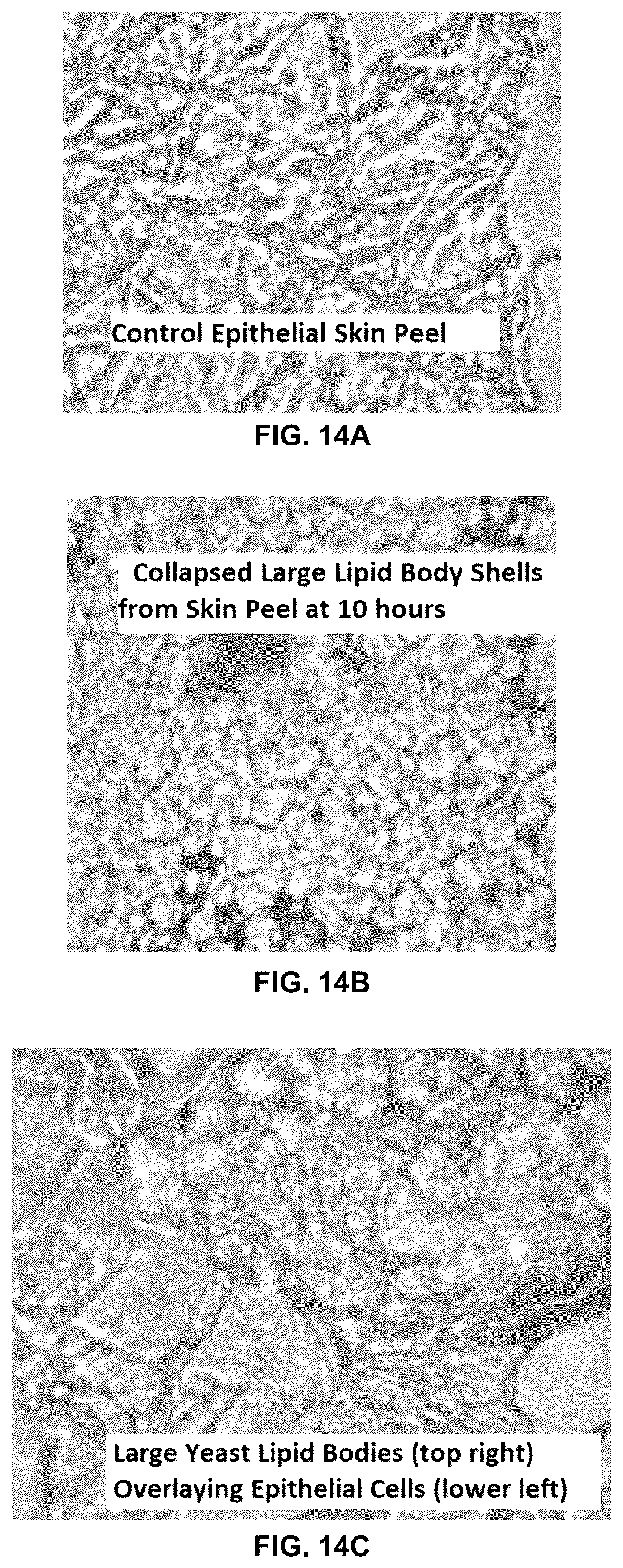 Patent US12350364 Figure 14 – Lipid body compositions, products made therefrom, methods of making same, and methods of use