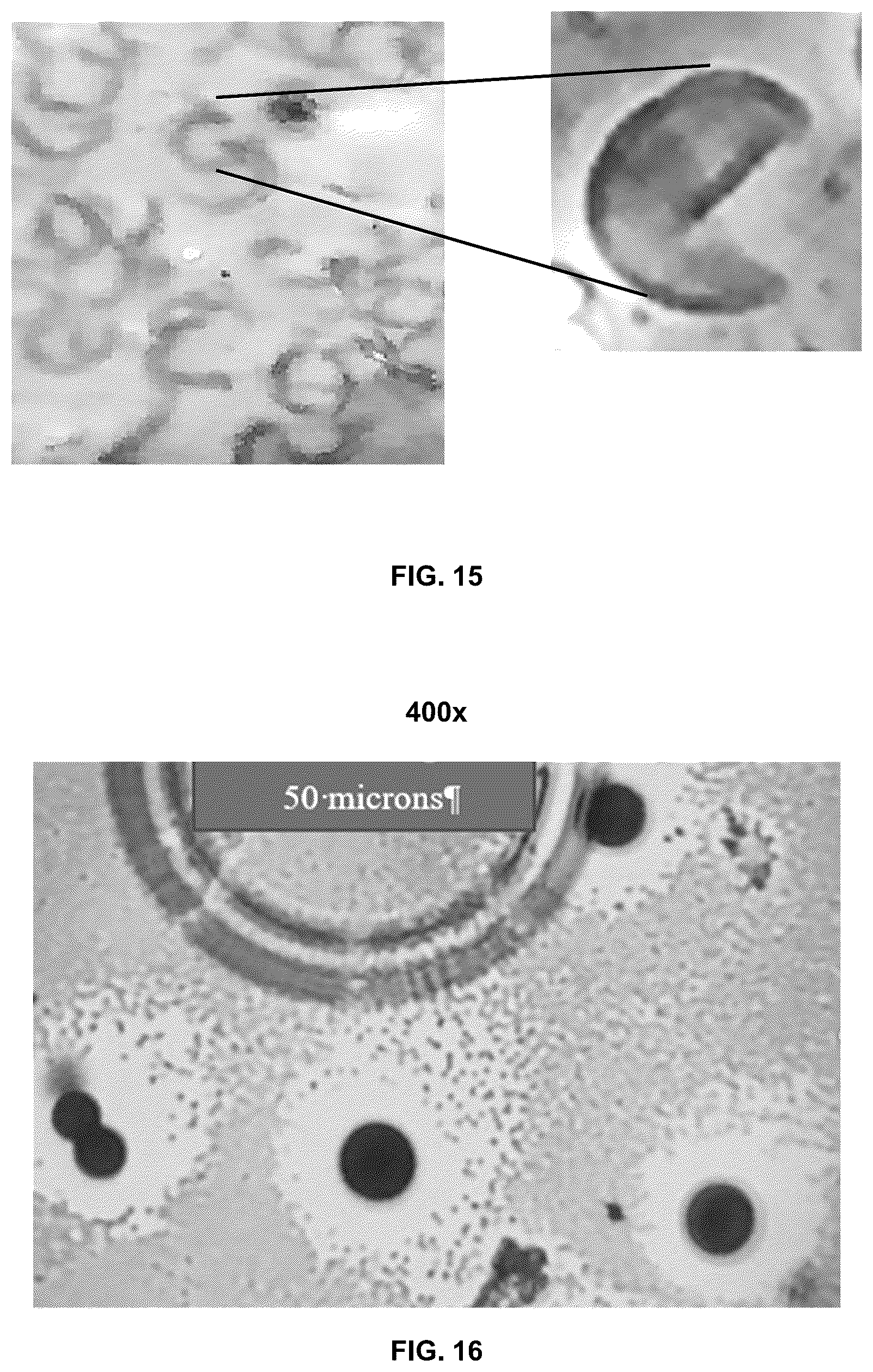 Patent US12350364 Figure 15 – Lipid body compositions, products made therefrom, methods of making same, and methods of use