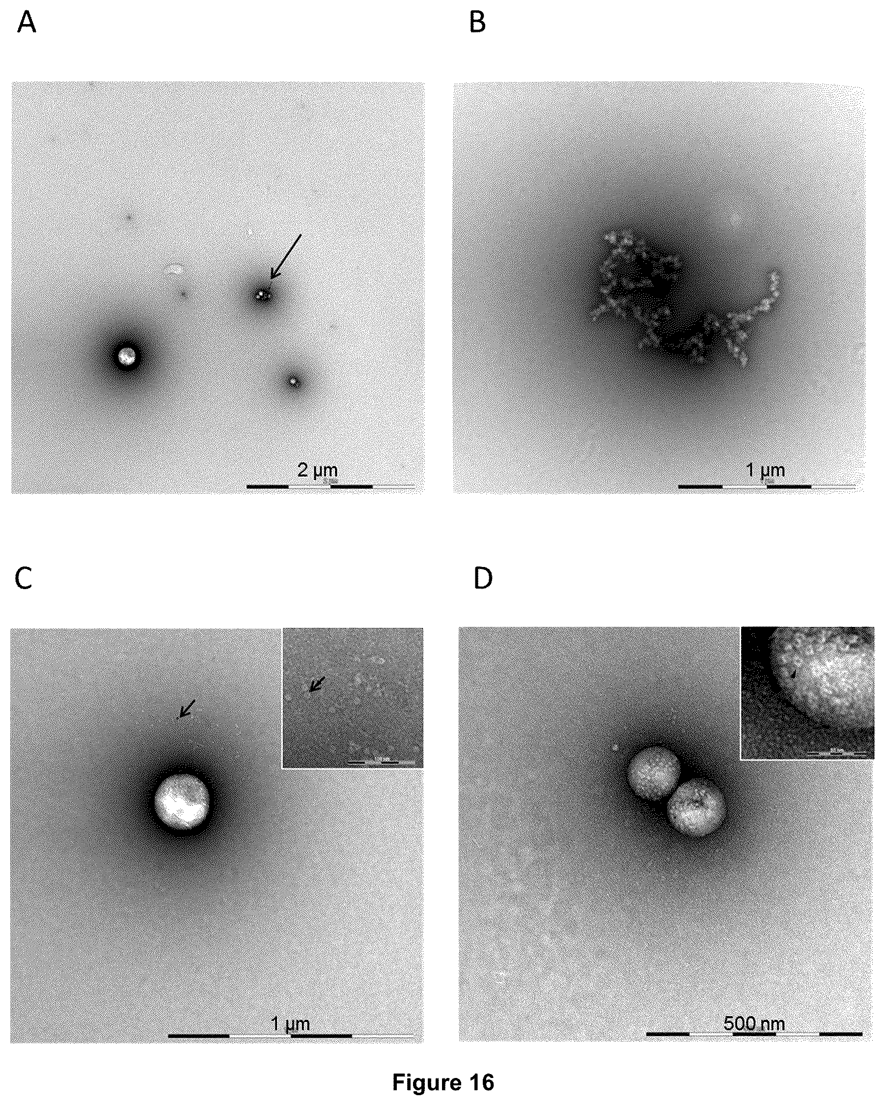 Patent US12350375 Figure 19 – Method for obtaining efficient viral vector-based compositions for vaccination or gene therapy