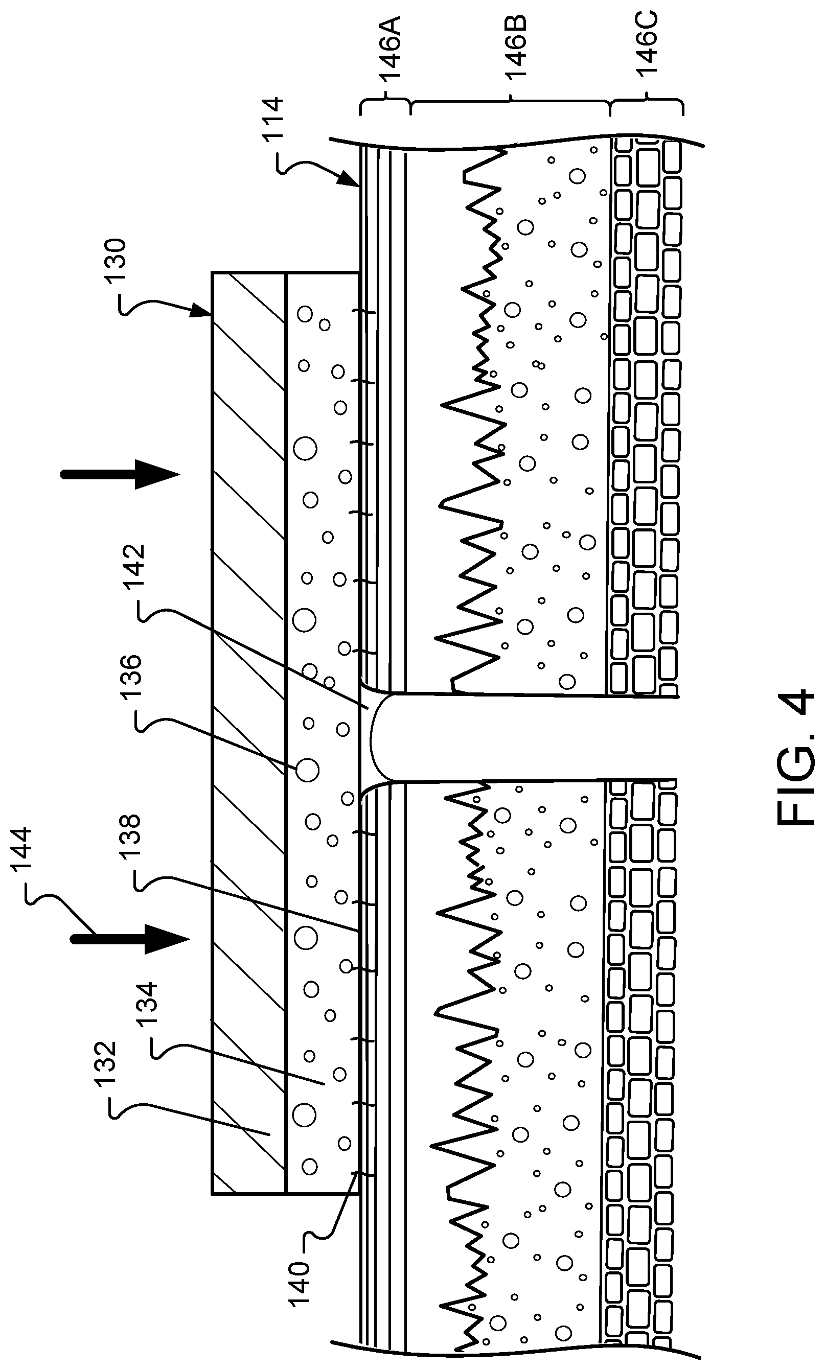 Patent US12350396 Figure 4 – Composite positive and negative Poisson's ratio tissue adhesives